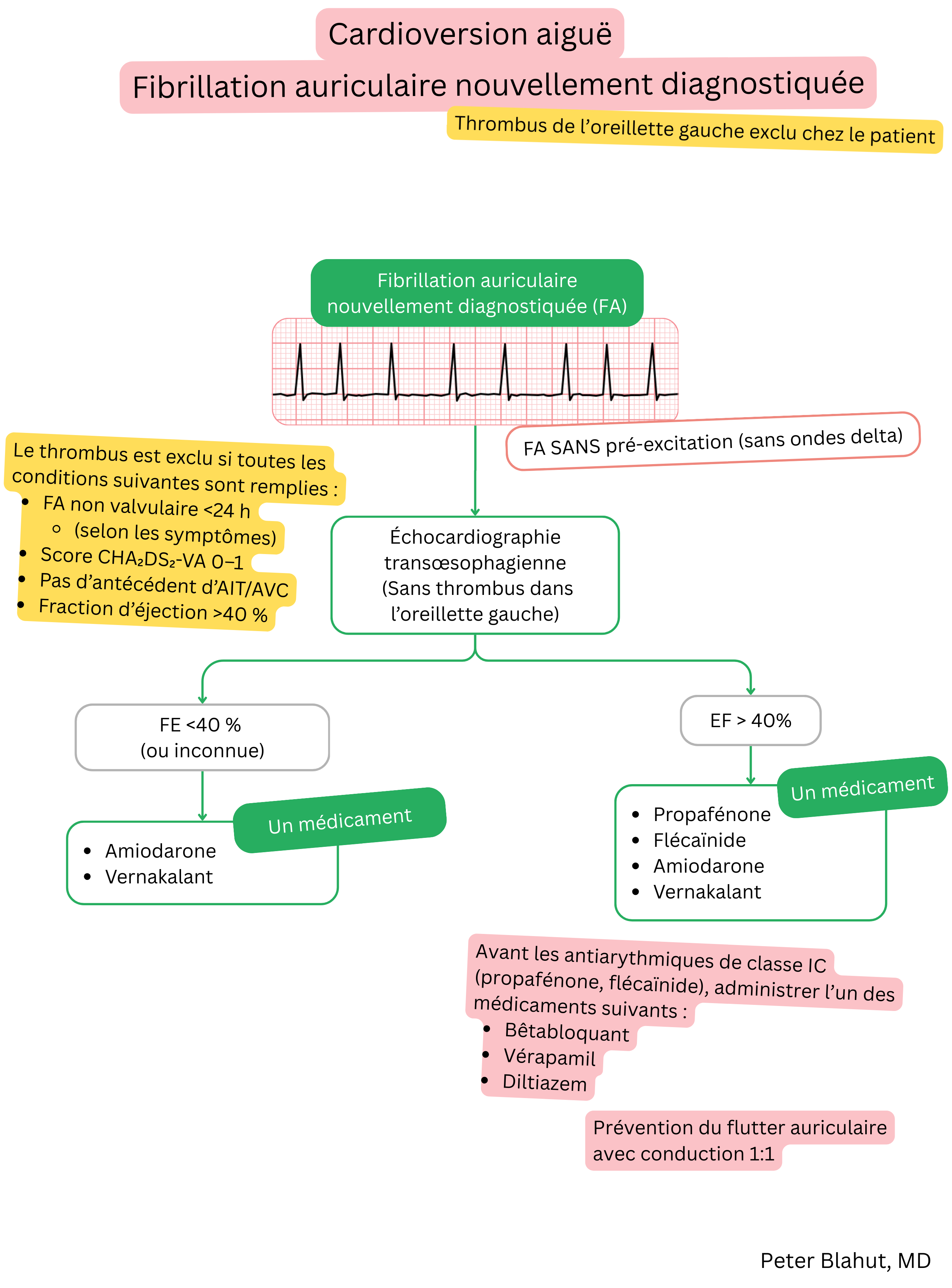 Algorithme de recommandations pour la cardioversion aiguë d’une fibrillation auriculaire récemment diagnostiquée sans préexcitation avec choix des antiarythmiques selon la fraction d’éjection ventriculaire gauche.