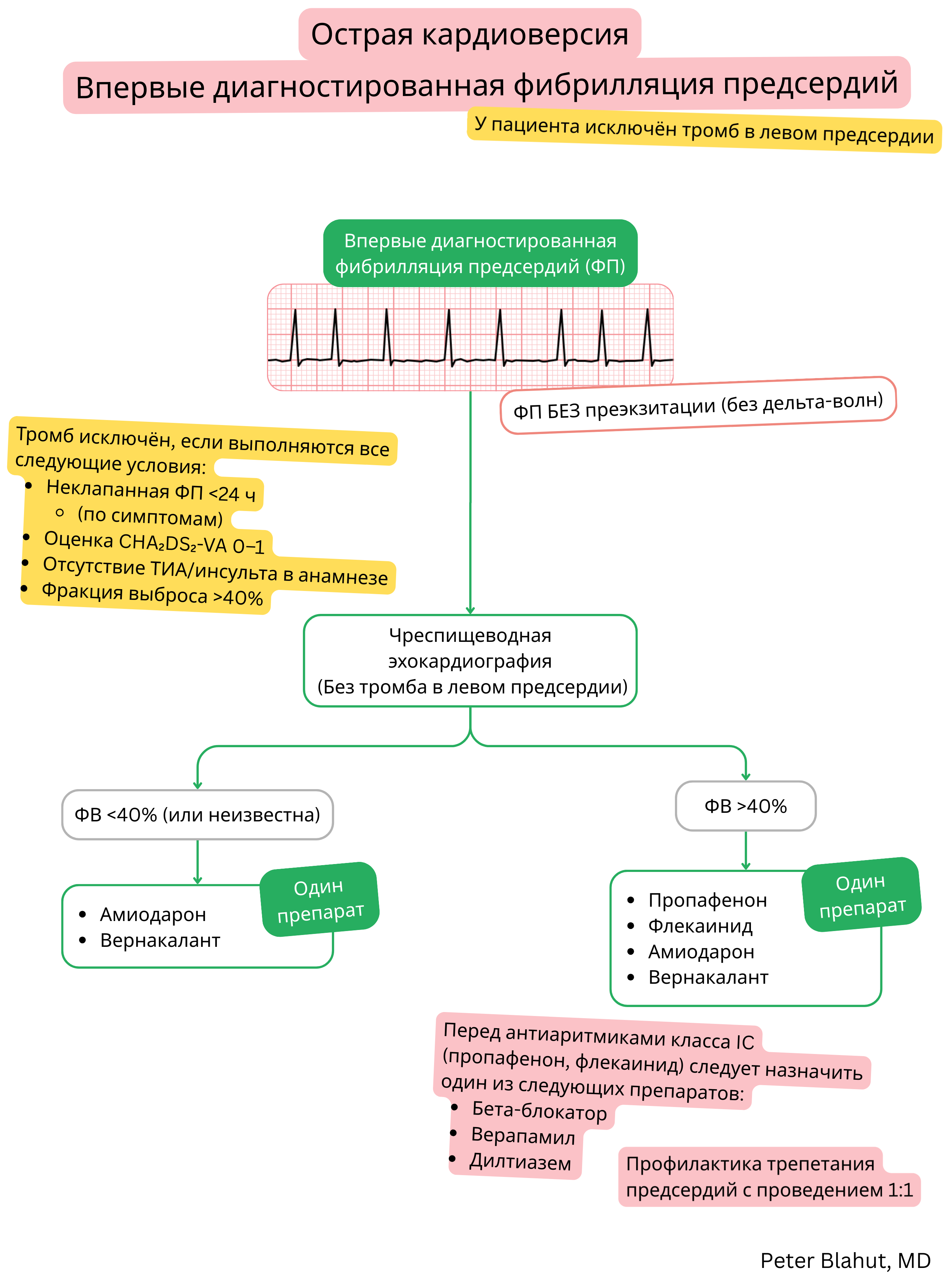 Алгоритм рекомендаций по острой кардиоверсии при впервые диагностированной фибрилляции предсердий без предвозбуждения с выбором антиаритмиков с учетом фракции выброса левого желудочка.