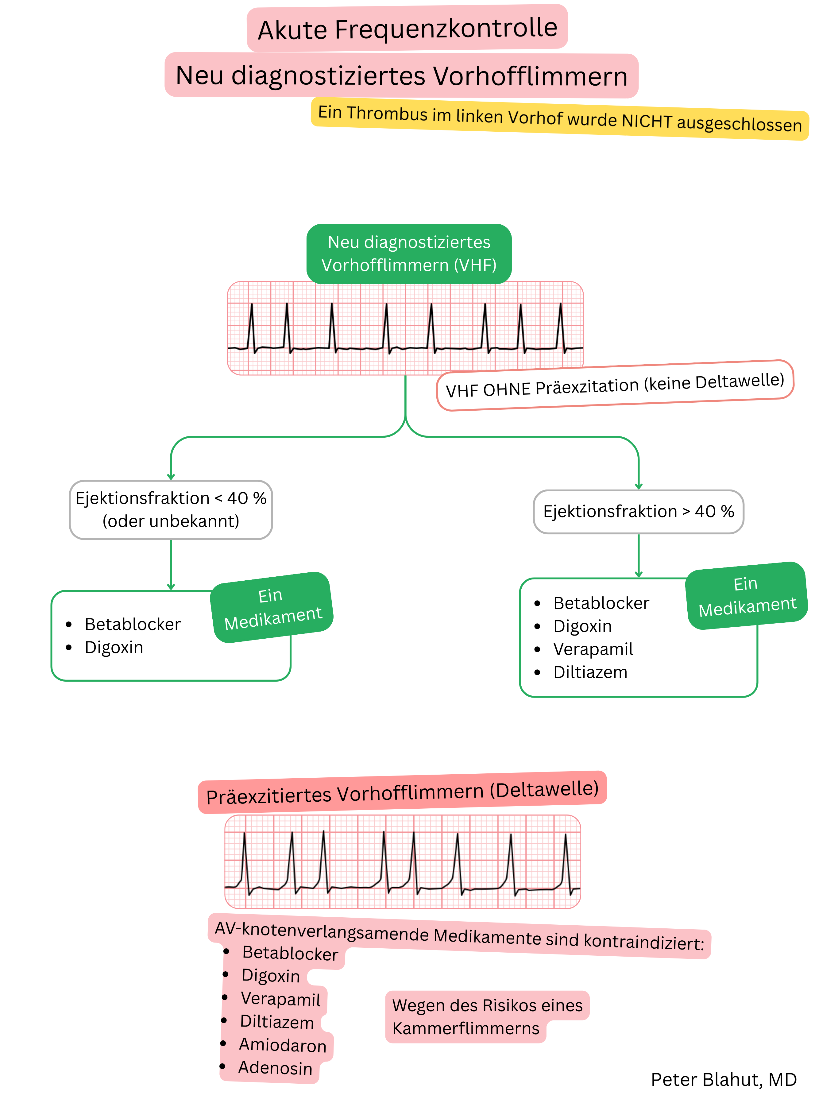 Leitlinienalgorithmus zur akuten Frequenzkontrolle bei neu diagnostiziertem Vorhofflimmern mit Therapieauswahl nach Ejektionsfraktion und Kontraindikation von AV-Knoten-Blockern bei Präexzitation.