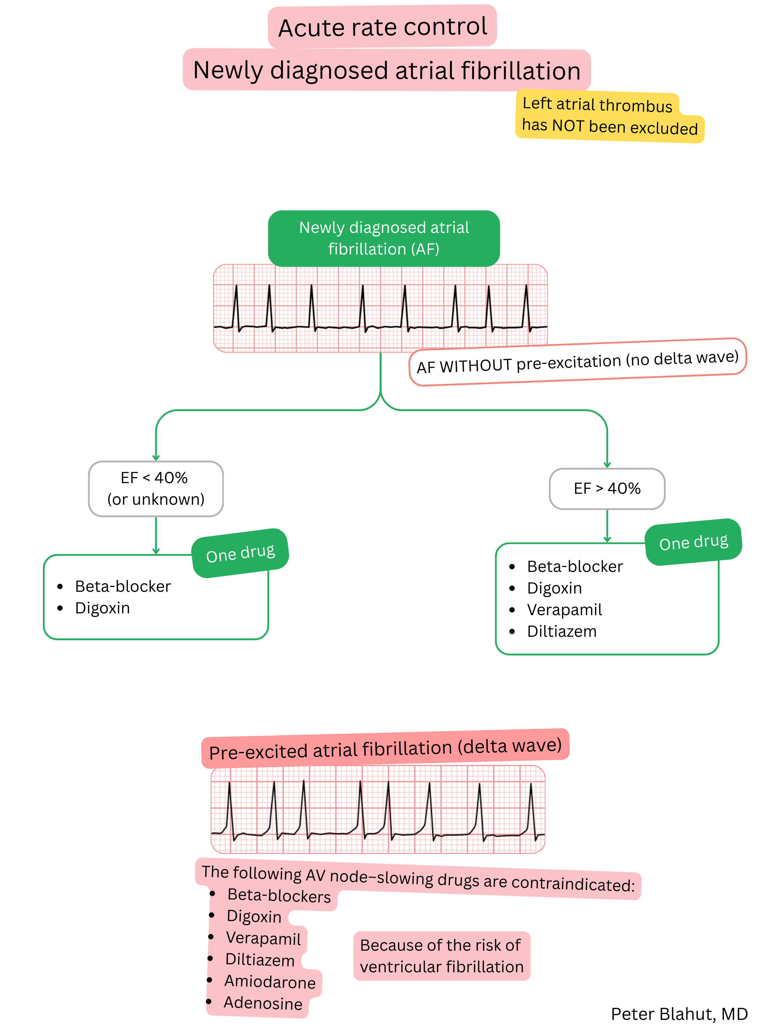 Guideline algorithm for acute rate control in newly diagnosed atrial fibrillation with treatment selection based on ejection fraction and contraindication to AV nodal blockers in pre-excitation.
