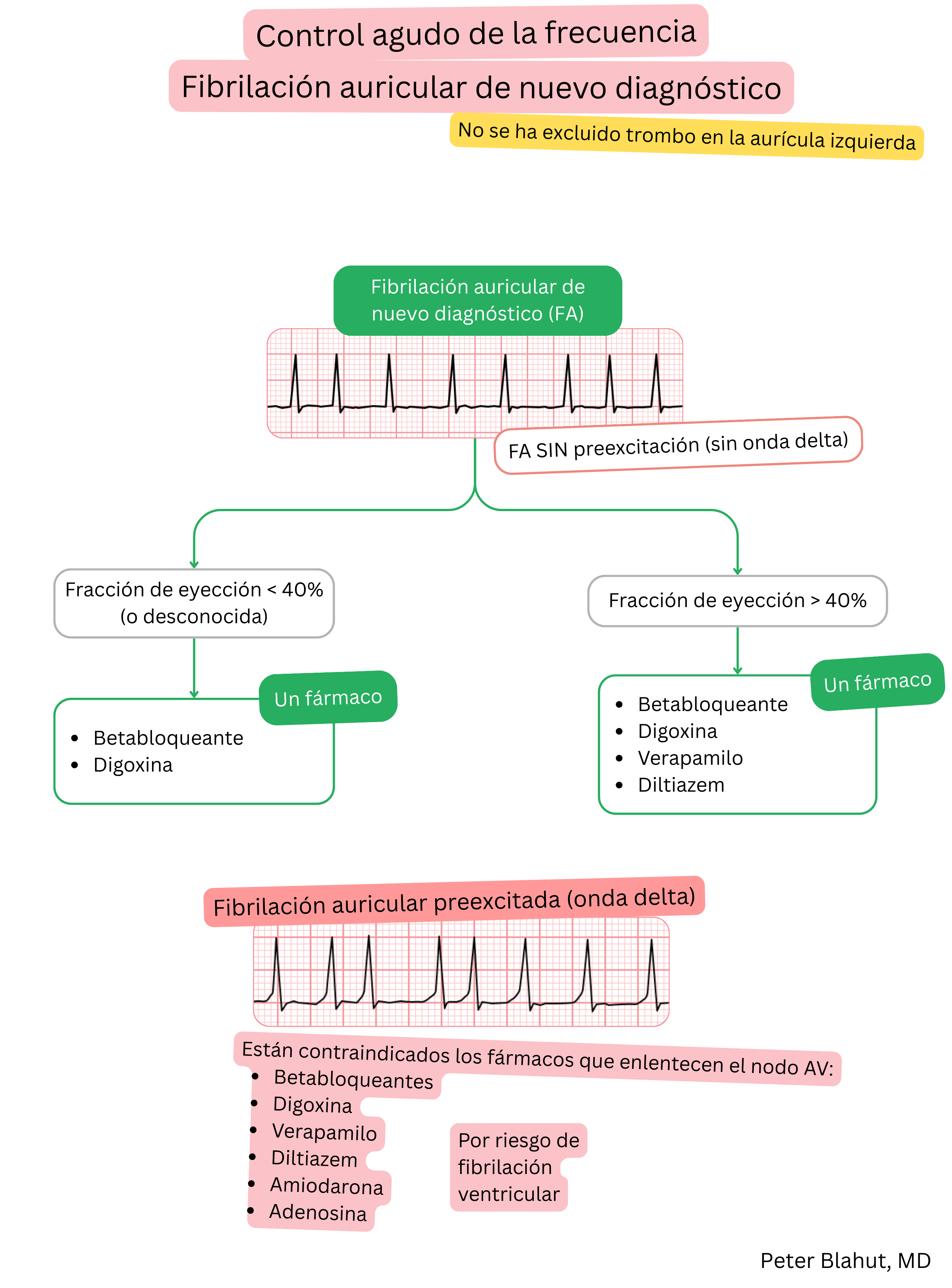 Algoritmo de recomendaciones para el control agudo de la frecuencia en fibrilación auricular de reciente diagnóstico con selección terapéutica según la fracción de eyección y contraindicación de bloqueadores del nodo AV en preexcitación.