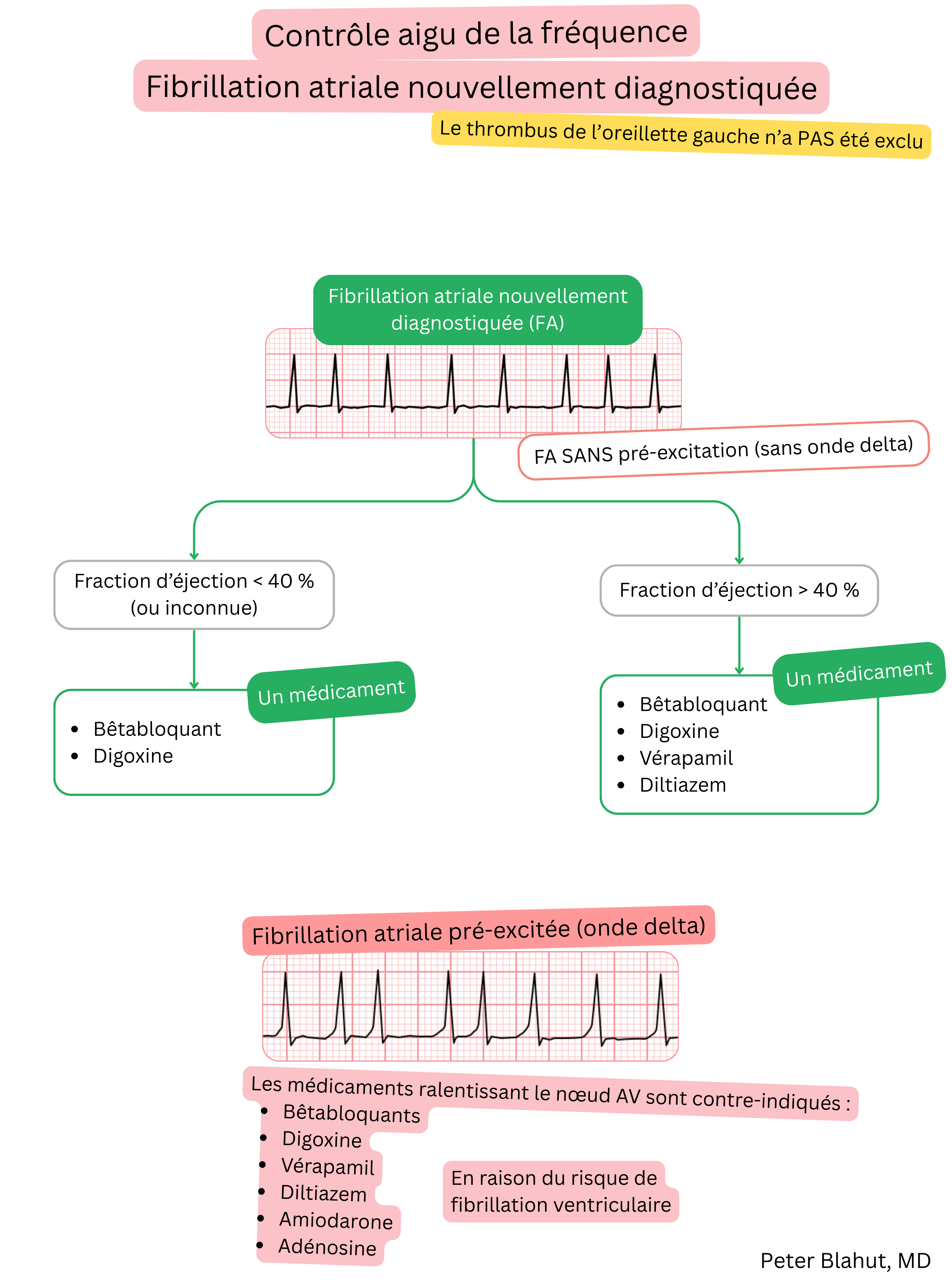 Algorithme de recommandations pour le contrôle aigu de la fréquence dans la fibrillation auriculaire récemment diagnostiquée avec choix du traitement selon la fraction d’éjection et contre-indication des bloqueurs du nœud AV en cas de préexcitation.