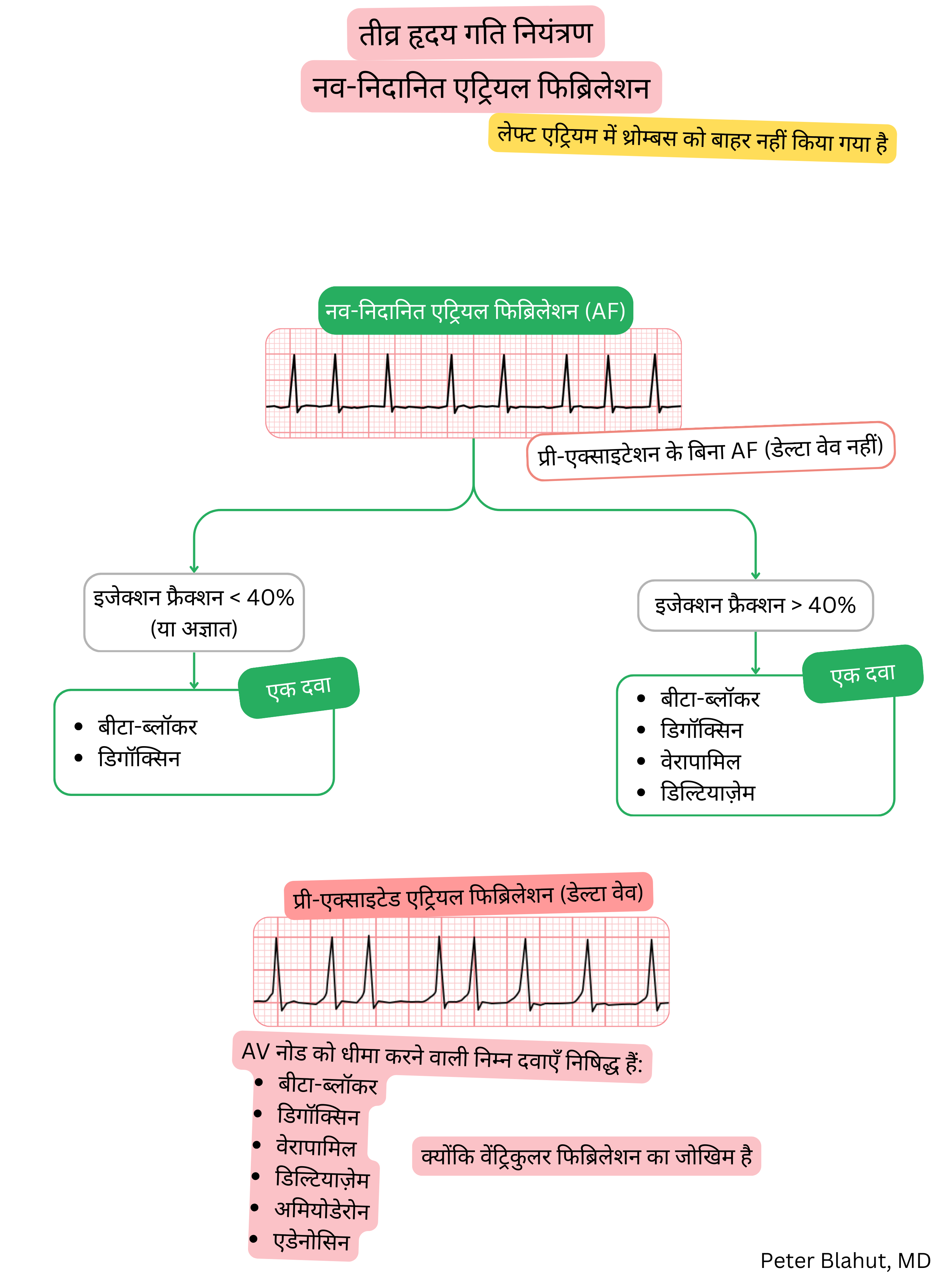 नव-निदानित एट्रियल फाइब्रिलेशन में तीव्र दर नियंत्रण हेतु दिशानिर्देश एल्गोरिदम, जिसमें इजेक्शन फ्रैक्शन के आधार पर उपचार चयन और प्री-एक्साइटेशन में AV नोडल ब्लॉकर निषिद्ध हैं।