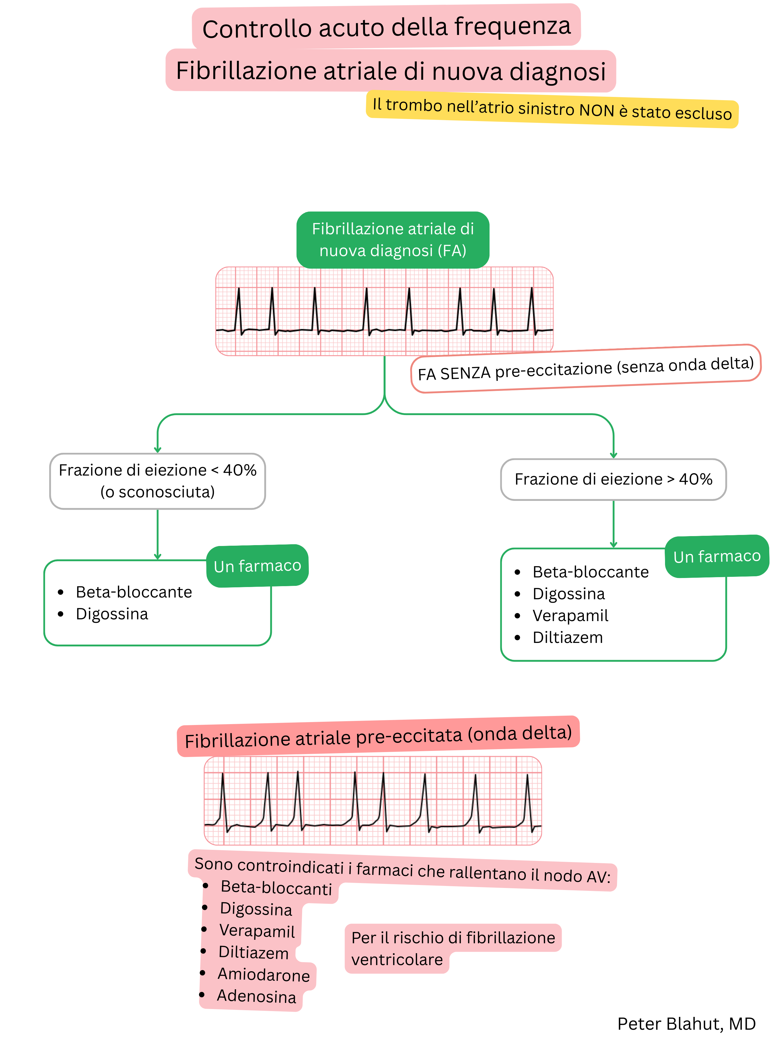 Algoritmo di raccomandazioni per il controllo acuto della frequenza nella fibrillazione atriale di nuova diagnosi con selezione terapeutica in base alla frazione di eiezione e controindicazione ai bloccanti del nodo AV in presenza di preeccitazione.