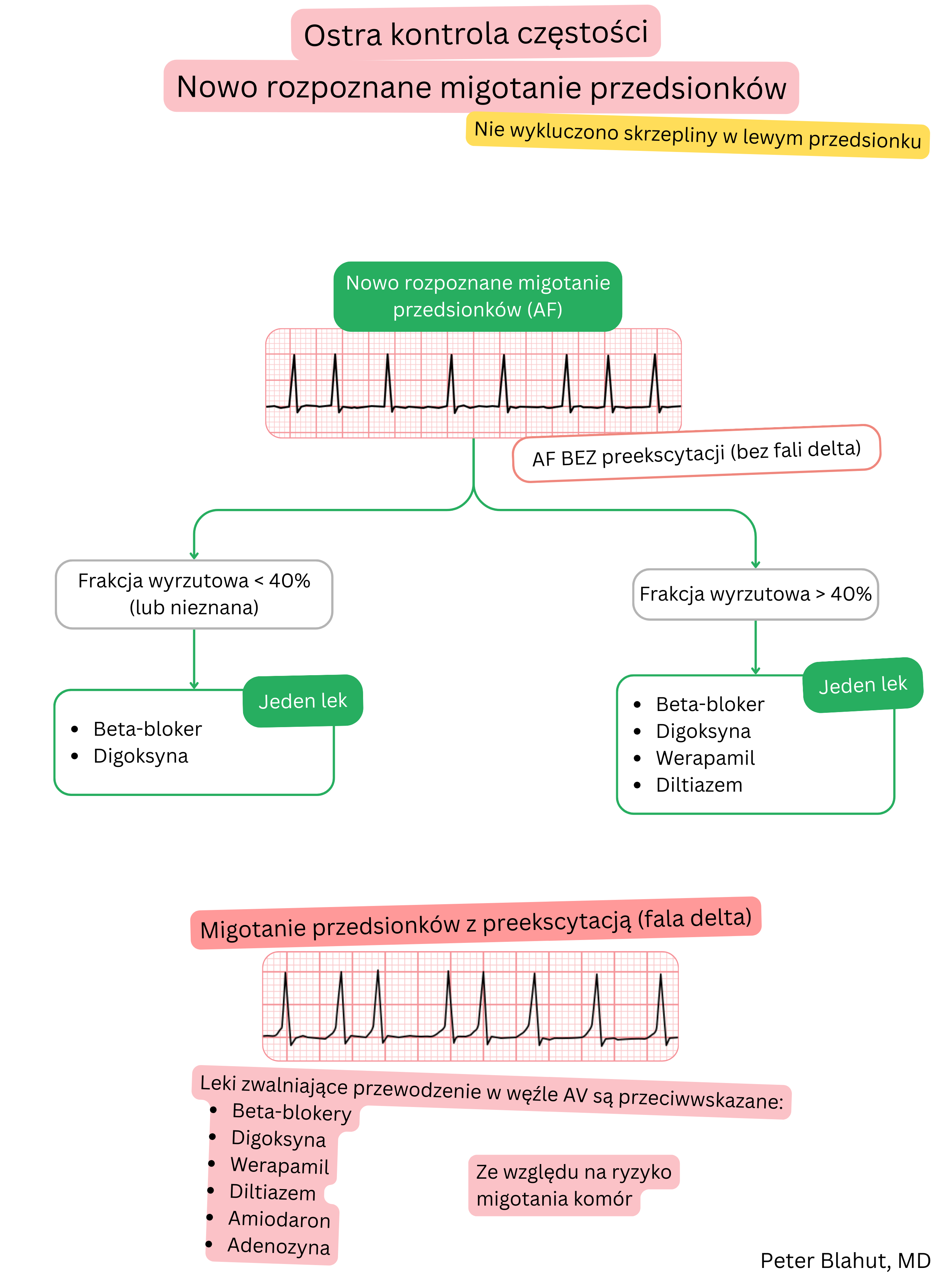 Algorytm zaleceń dotyczących ostrej kontroli częstości w świeżo rozpoznanym migotaniu przedsionków z doborem leczenia zależnie od frakcji wyrzutowej oraz przeciwwskazaniem do blokerów węzła AV w preekscytacji.