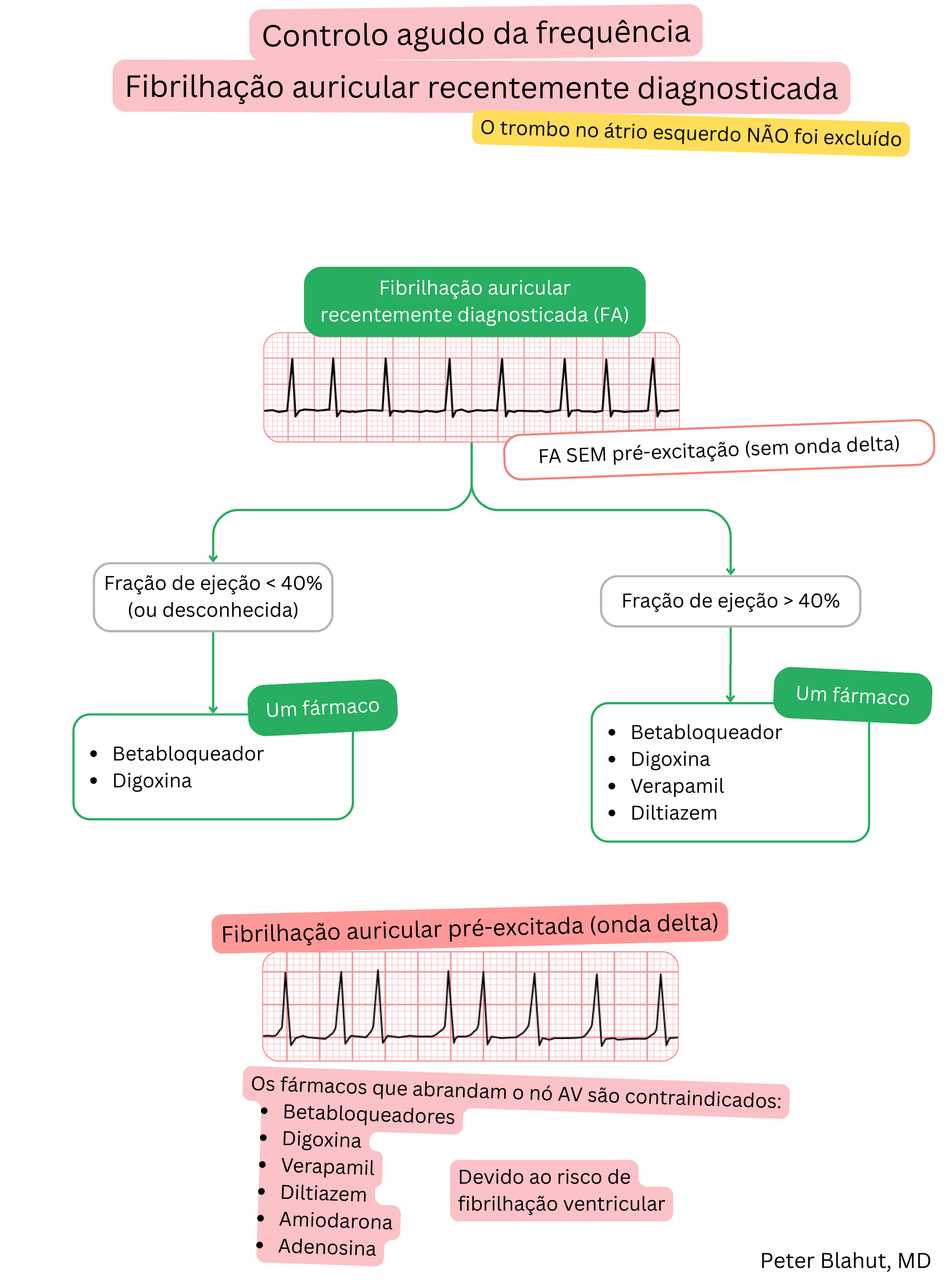 Algoritmo de recomendações para controle agudo da frequência na fibrilação atrial recém-diagnosticada com seleção do tratamento conforme a fração de ejeção e contraindicação de bloqueadores do nó AV na pré-excitação.