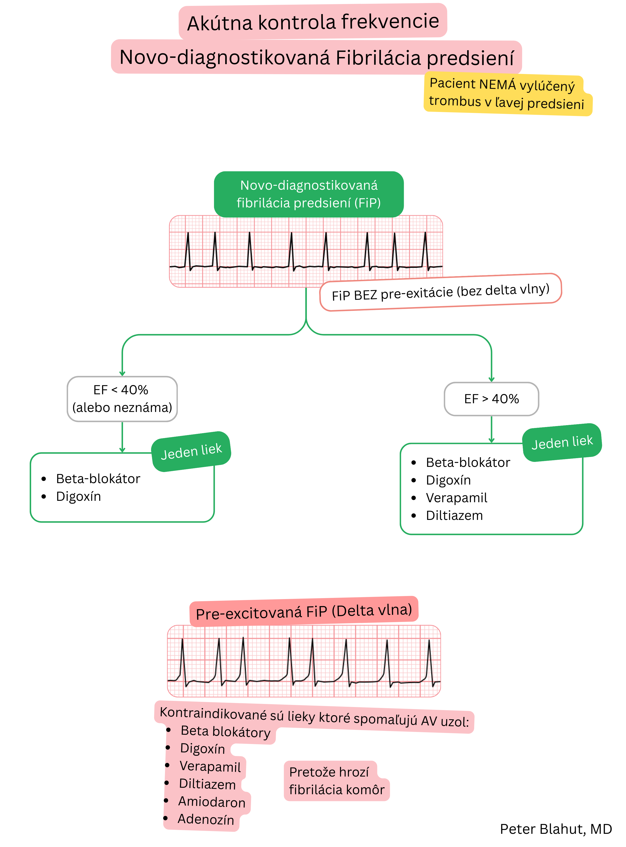 Schéma odporúčaní pre akútnu kontrolu frekvencie pri novodiagnostikovanej fibrilácii predsiení s výberom liečby podľa ejekčnej frakcie a kontraindikáciou AV nodálnych blokátorov pri preexcitácii.