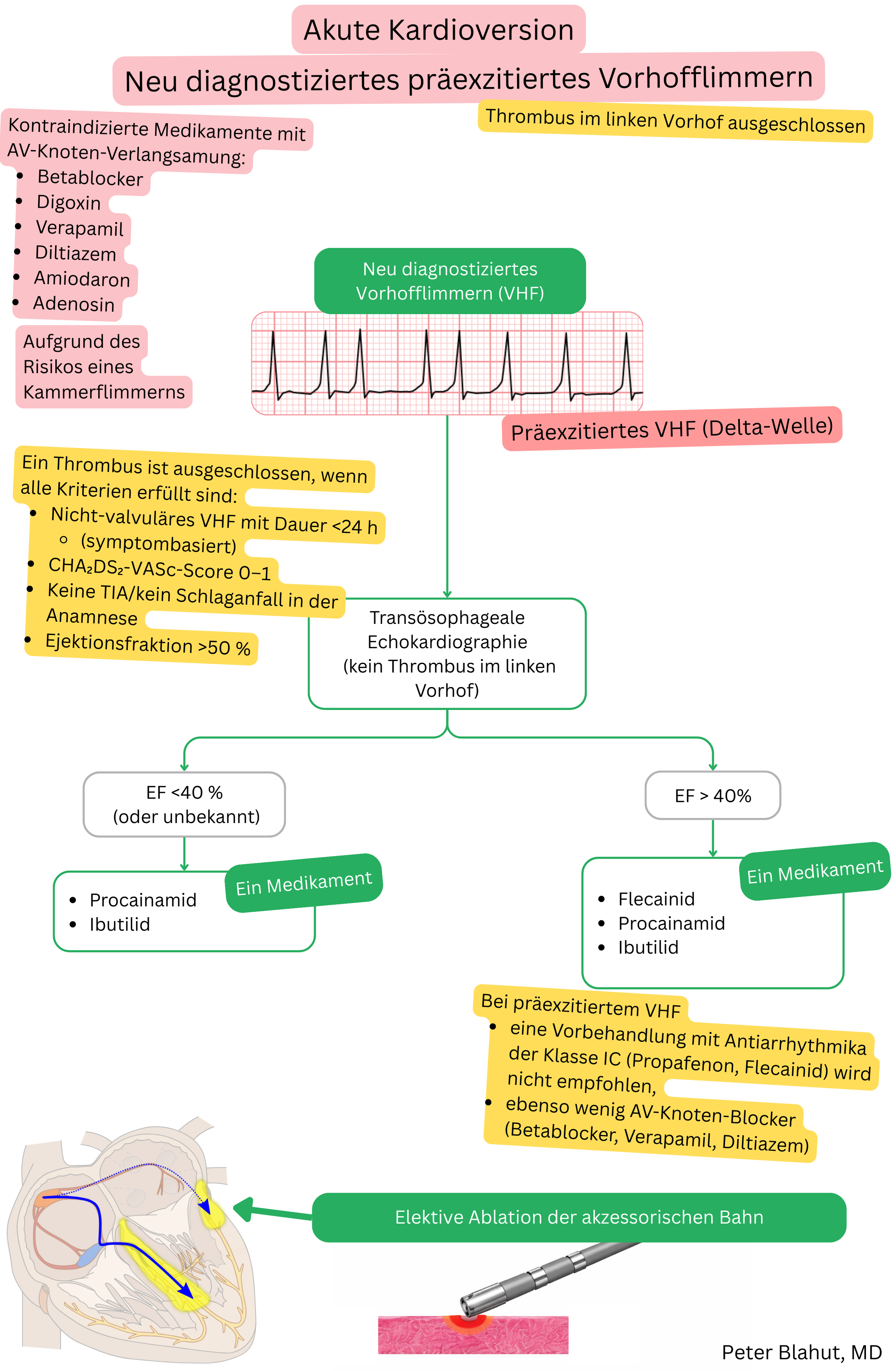 Leitlinienalgorithmus zur akuten Kardioversion bei neu diagnostiziertem präexzitiertem Vorhofflimmern mit Kontraindikation für AV-Knoten-Blocker und Auswahl von Antiarrhythmika nach Ejektionsfraktion.
