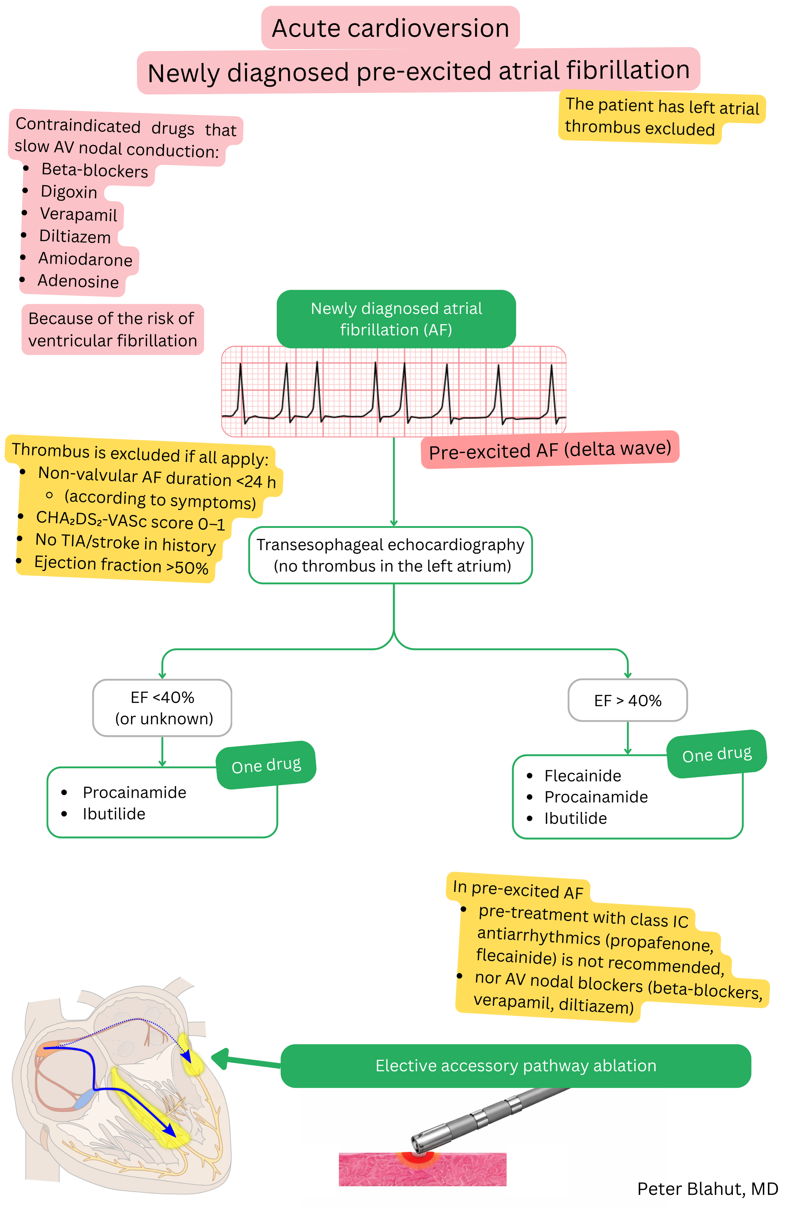 Guideline algorithm for acute cardioversion in newly diagnosed pre-excited atrial fibrillation with contraindication to AV nodal blockers and antiarrhythmic selection based on ejection fraction.