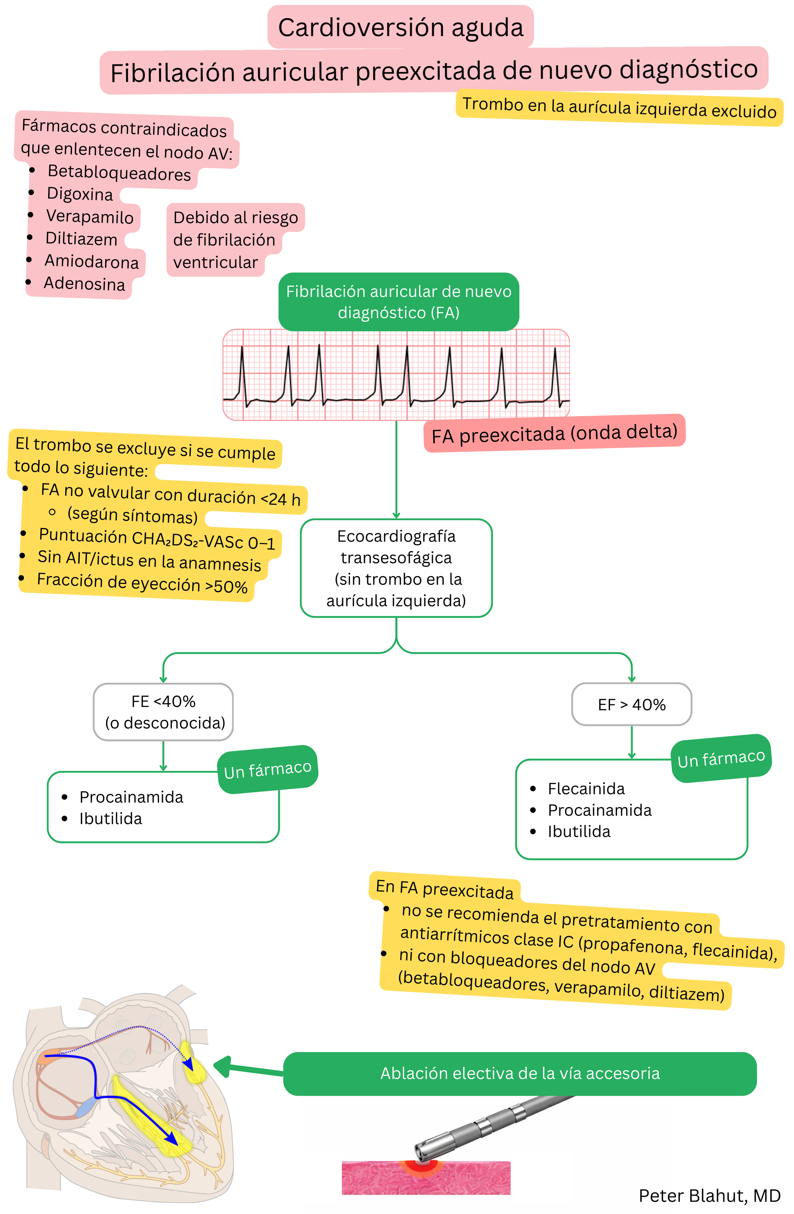 Algoritmo de recomendaciones para cardioversión aguda en fibrilación auricular preexcitada de reciente diagnóstico con contraindicación de bloqueadores del nodo AV y selección de antiarrítmicos según fracción de eyección.