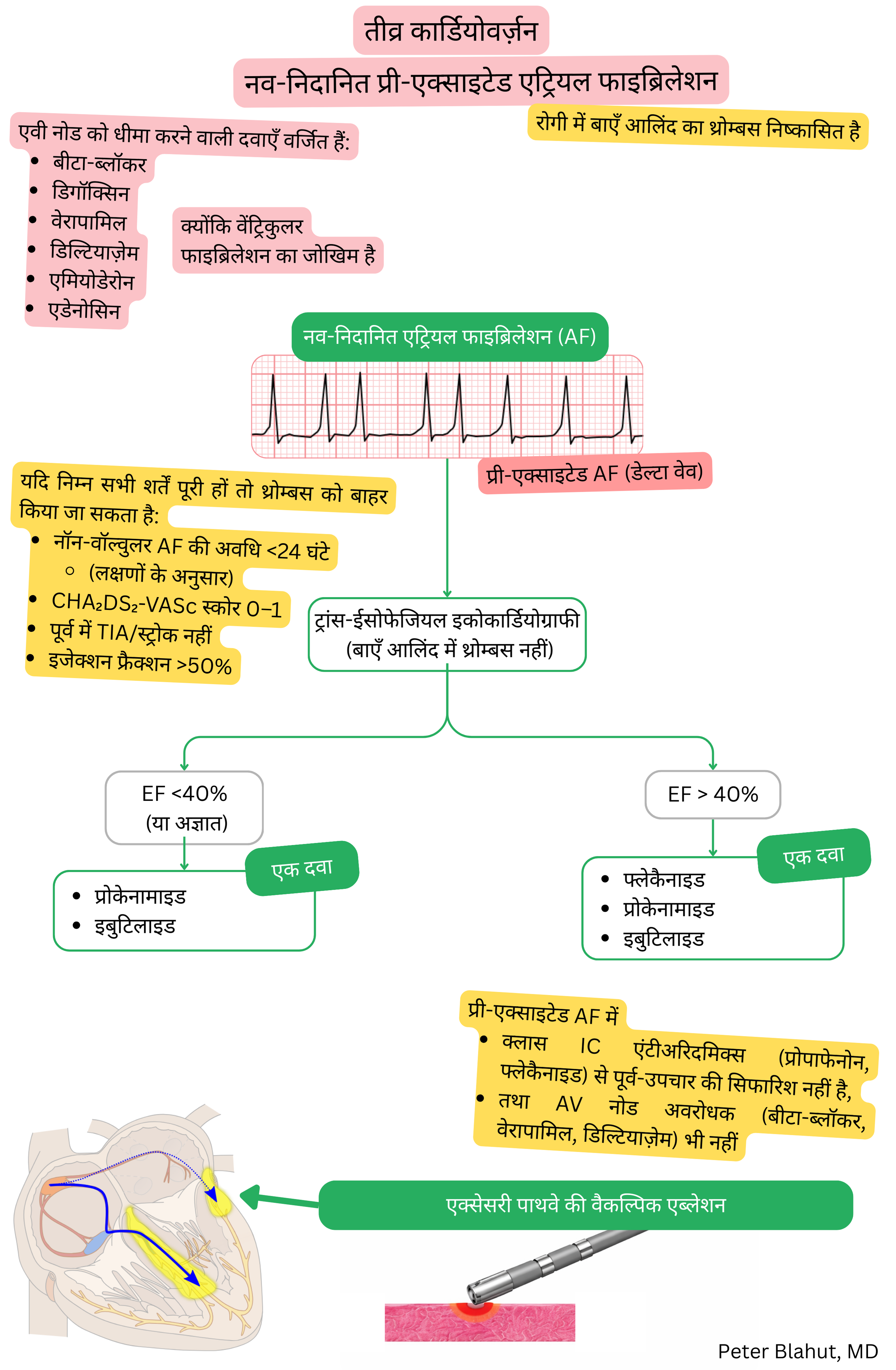 नव-निदानित प्री-एक्साइटेड एट्रियल फाइब्रिलेशन में तीव्र कार्डियोवर्जन हेतु दिशानिर्देश एल्गोरिदम, जिसमें AV नोडल ब्लॉकर निषिद्ध हैं और इजेक्शन फ्रैक्शन के आधार पर एंटीएरिदमिक चयन शामिल है।