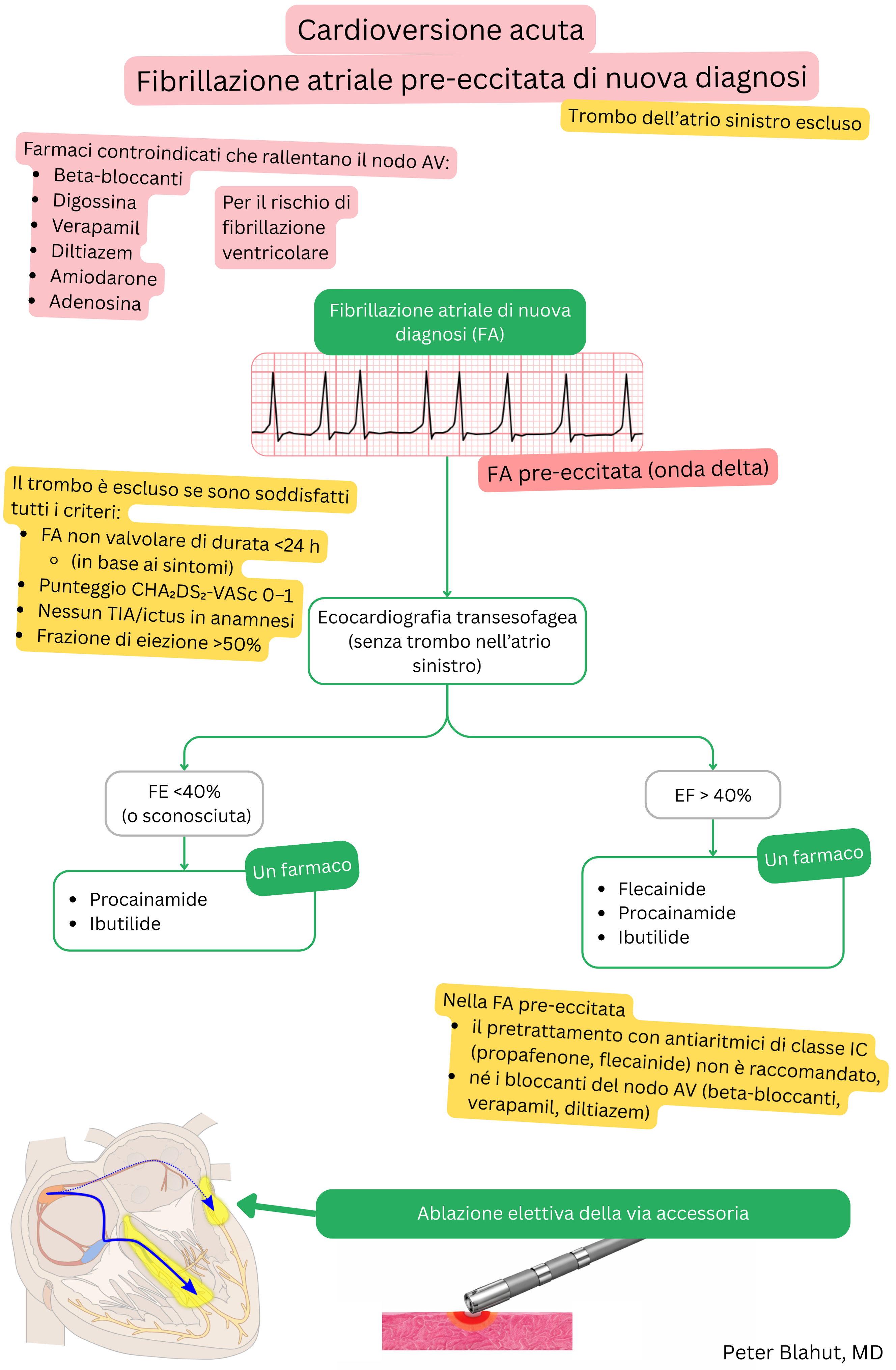 Algoritmo di raccomandazioni per cardioversione acuta nella fibrillazione atriale preeccitata di nuova diagnosi con controindicazione ai bloccanti del nodo AV e selezione degli antiaritmici in base alla frazione di eiezione.