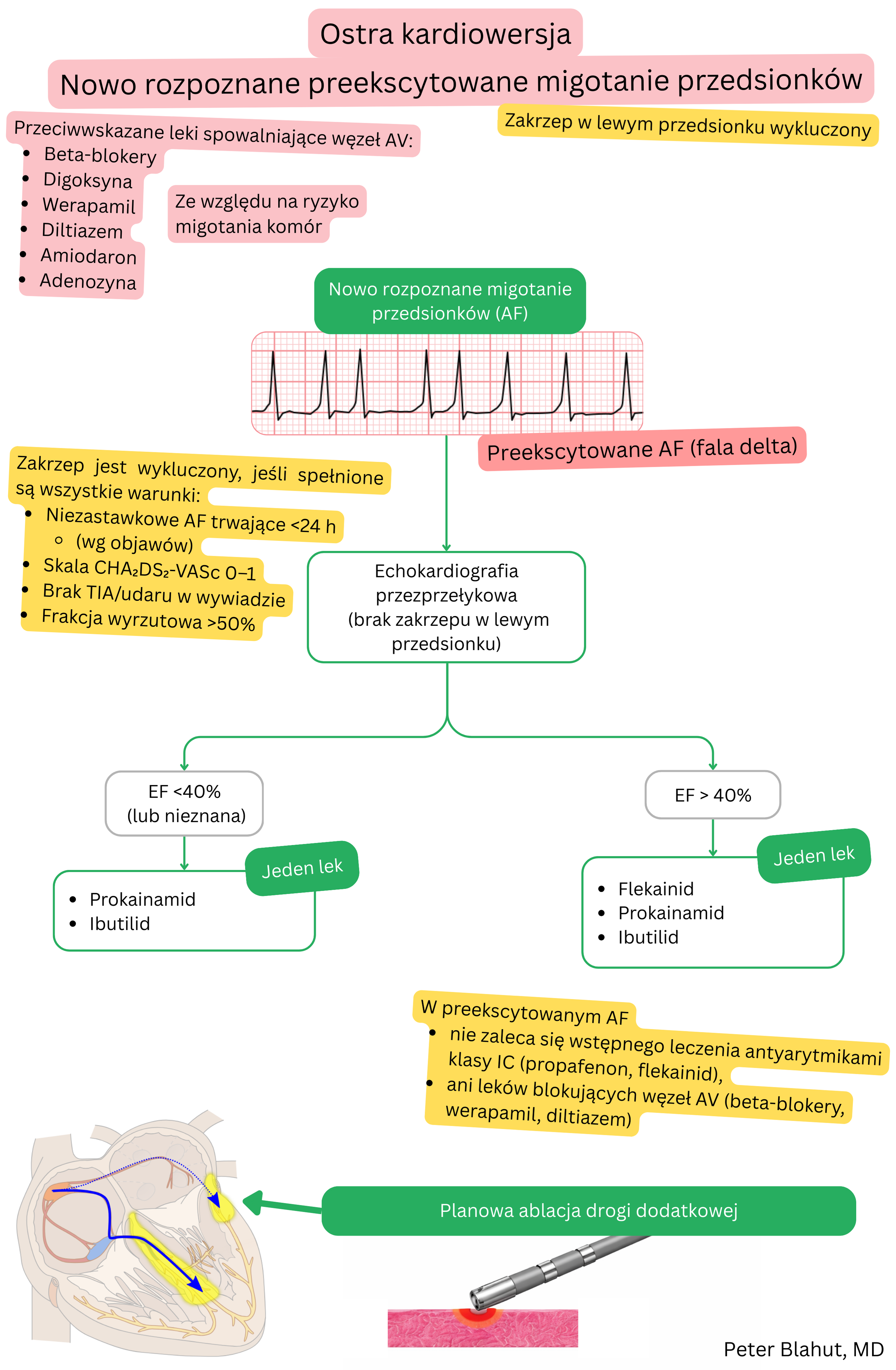 Algorytm zaleceń dotyczących ostrej kardiowersji w świeżo rozpoznanym migotaniu przedsionków z preekscytacją z przeciwwskazaniem do blokerów węzła AV oraz doborem leków antyarytmicznych według frakcji wyrzutowej.