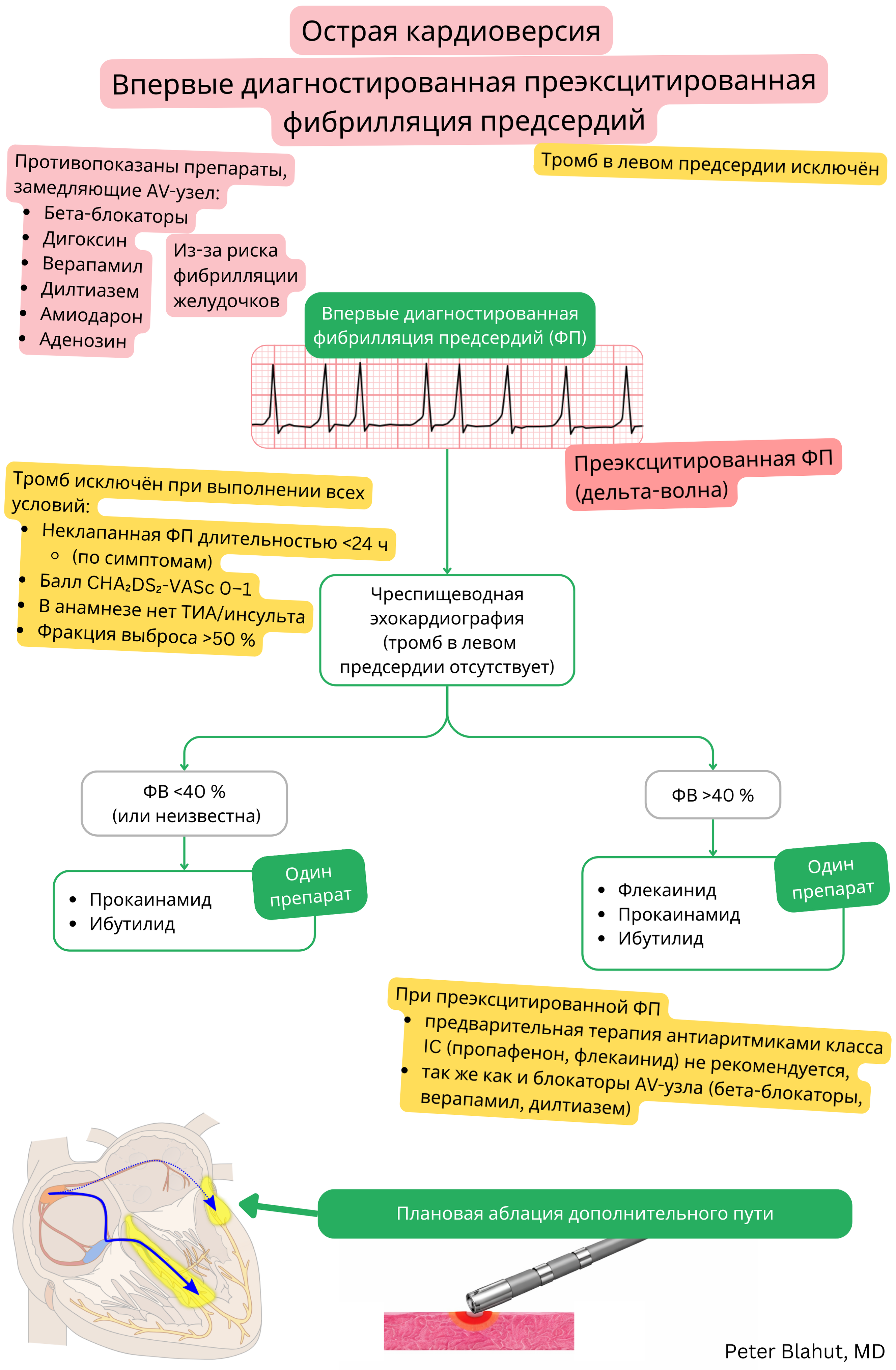 Алгоритм рекомендаций по острой кардиоверсии при впервые диагностированной предвозбужденной фибрилляции предсердий с противопоказанием к блокаторам АВ-узла и выбором антиаритмиков с учетом фракции выброса.