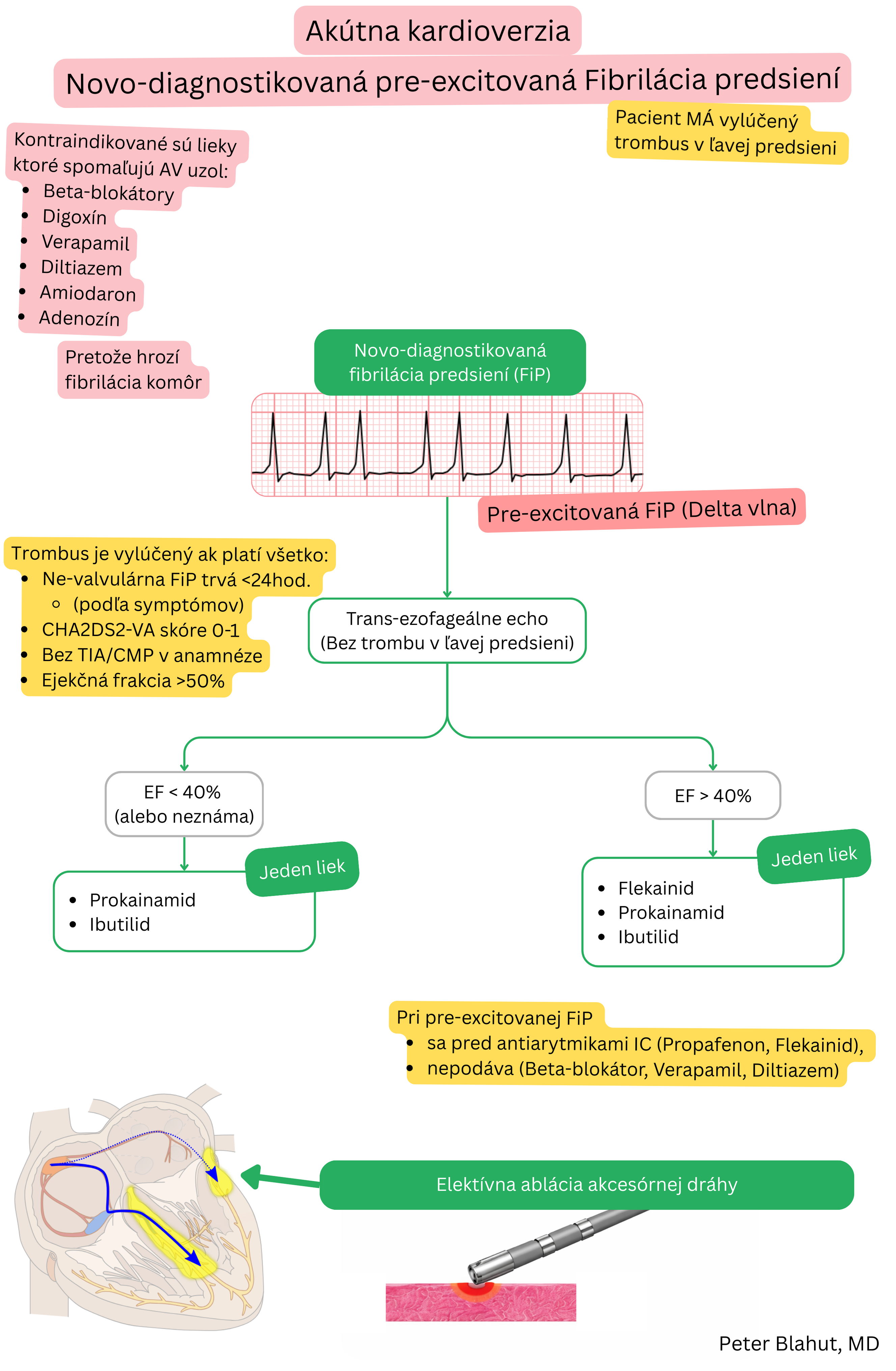 Schéma odporúčaní pre akútnu kardioverziu pri novodiagnostikovanej preexcitovanej fibrilácii predsiení s kontraindikáciou AV nodálnych blokátorov a výberom antiarytmík podľa ejekčnej frakcie.