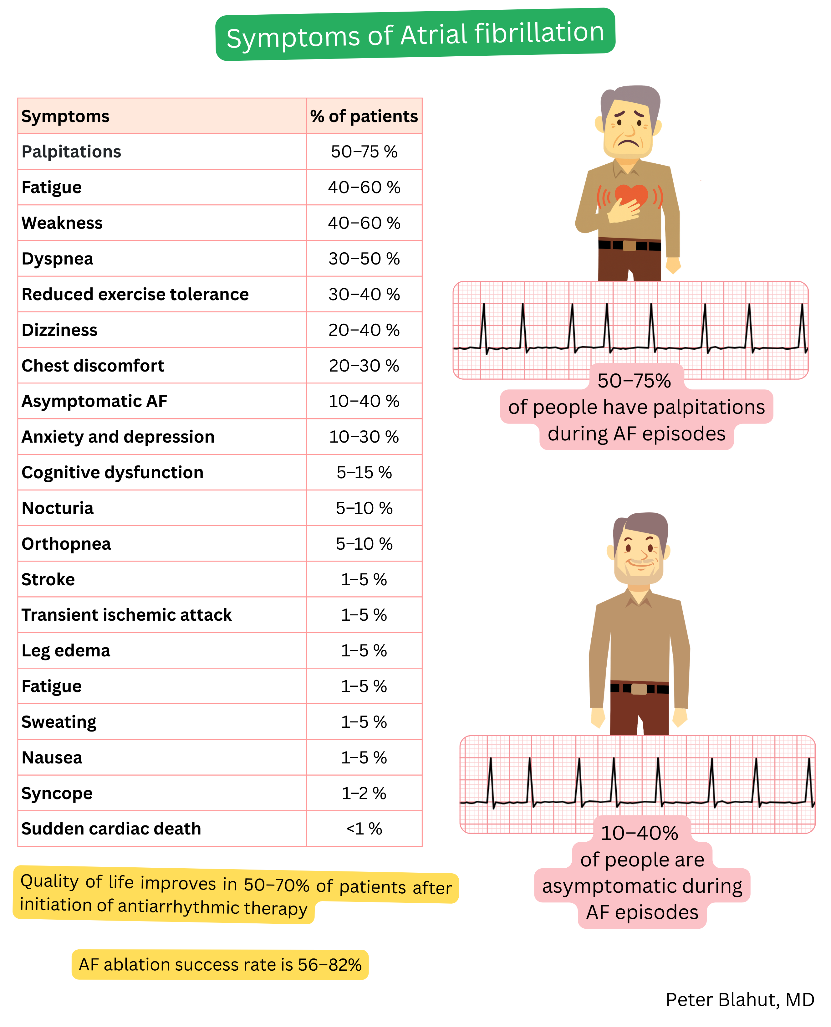 Table of atrial fibrillation symptoms with percentage prevalence of palpitations, dyspnea, and asymptomatic presentation complemented by an illustrative ECG showing an irregular ventricular response.