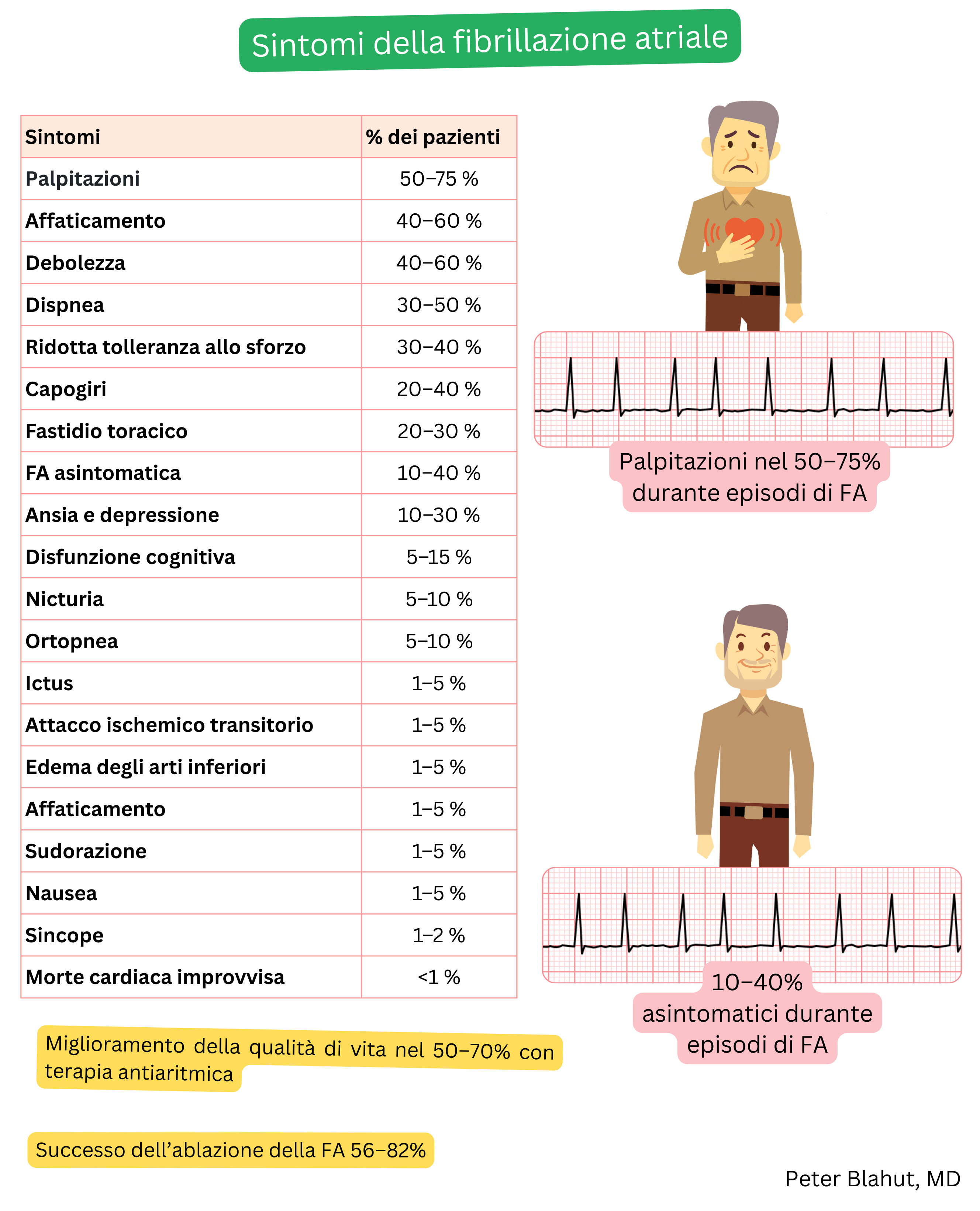 Tabella dei sintomi della fibrillazione atriale con prevalenza percentuale di palpitazioni, dispnea e decorso asintomatico, integrata da un ECG illustrativo con risposta ventricolare irregolare.