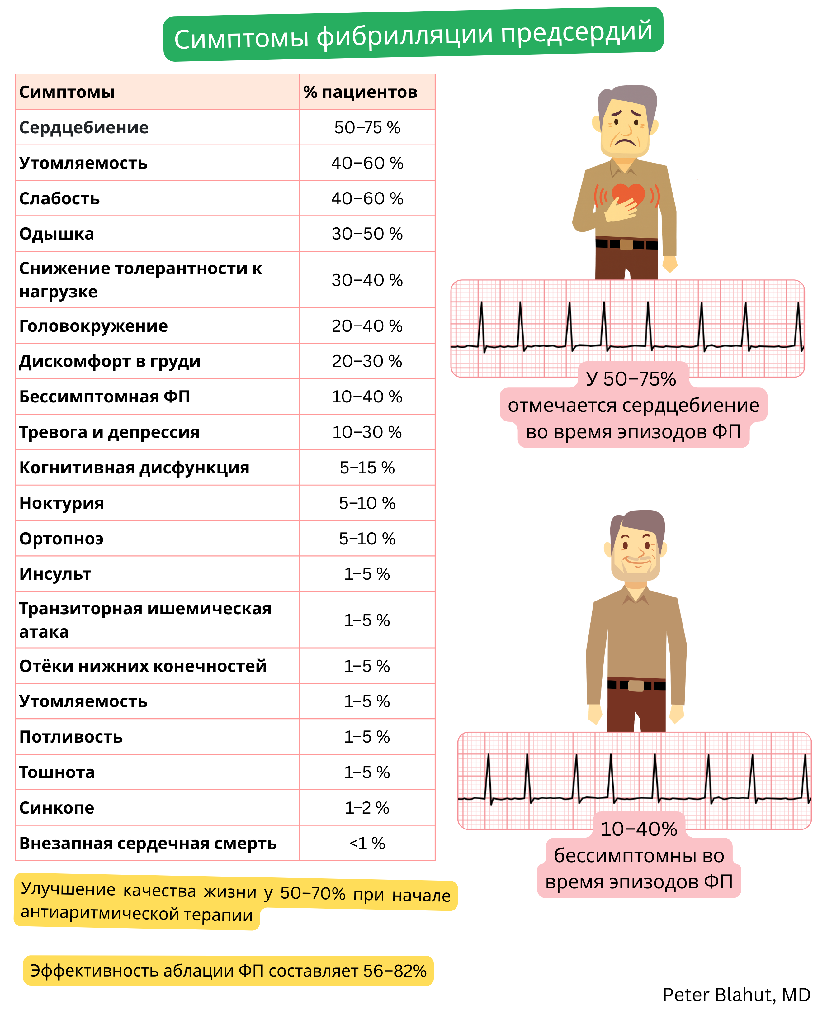 Таблица симптомов фибрилляции предсердий с процентной распространённостью сердцебиений, одышки и бессимптомного течения, дополненная иллюстративной ЭКГ с нерегулярным желудочковым ответом.