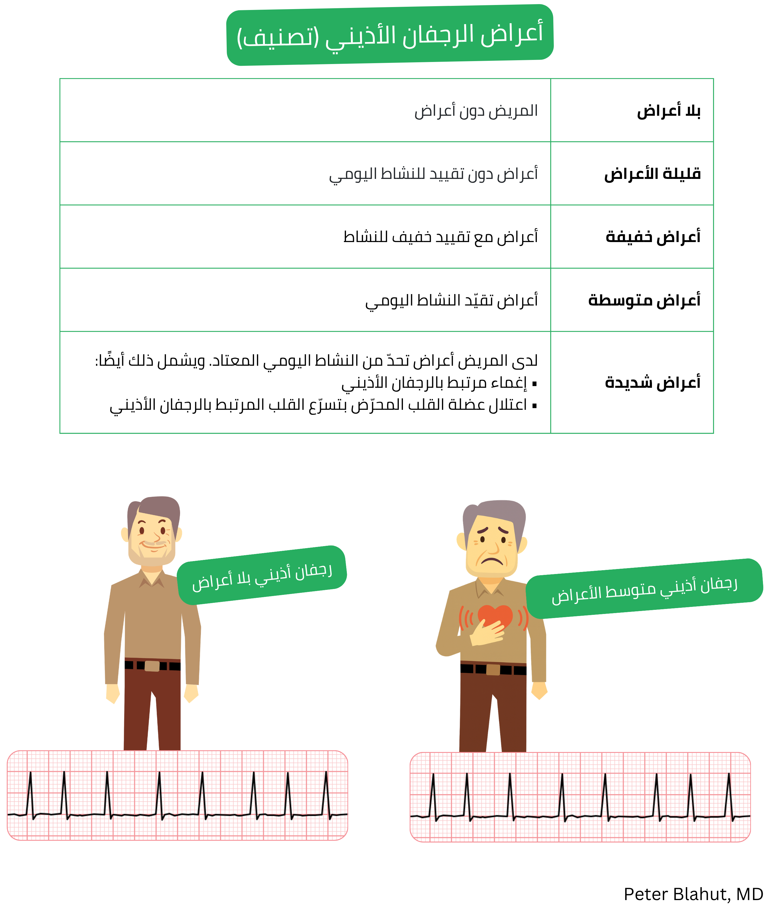 جدول تصنيف شدة أعراض الرجفان الأذيني حسب درجة العبء العرضي من الحالات اللاعرضية إلى الشديدة مع بيان العواقب السريرية المترتبة.