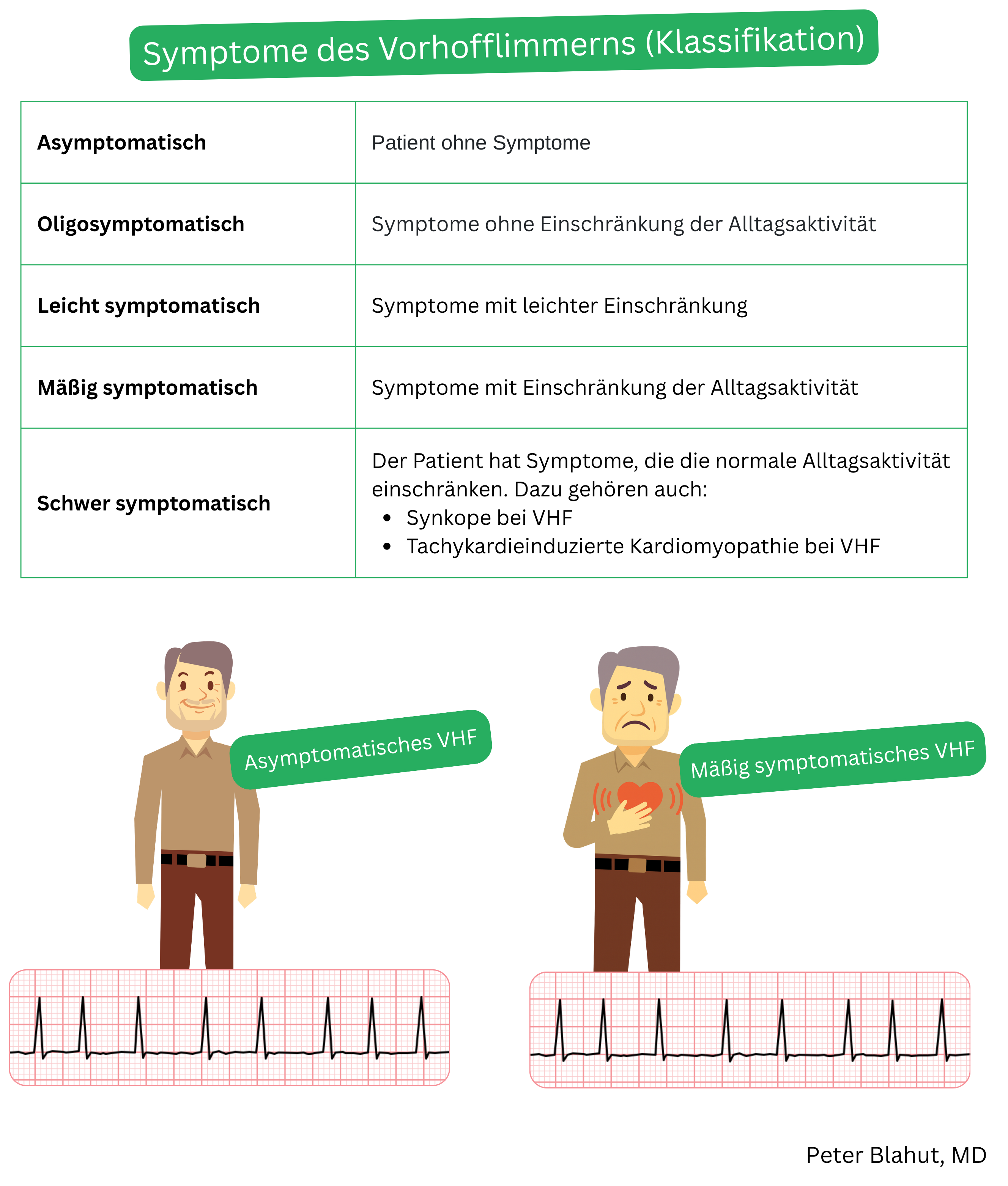 Tabelle zur Klassifikation der Symptomschwere bei Vorhofflimmern nach dem Ausmaß der Symptomatik von asymptomatisch bis stark symptomatisch mit Angabe der klinischen Konsequenzen.