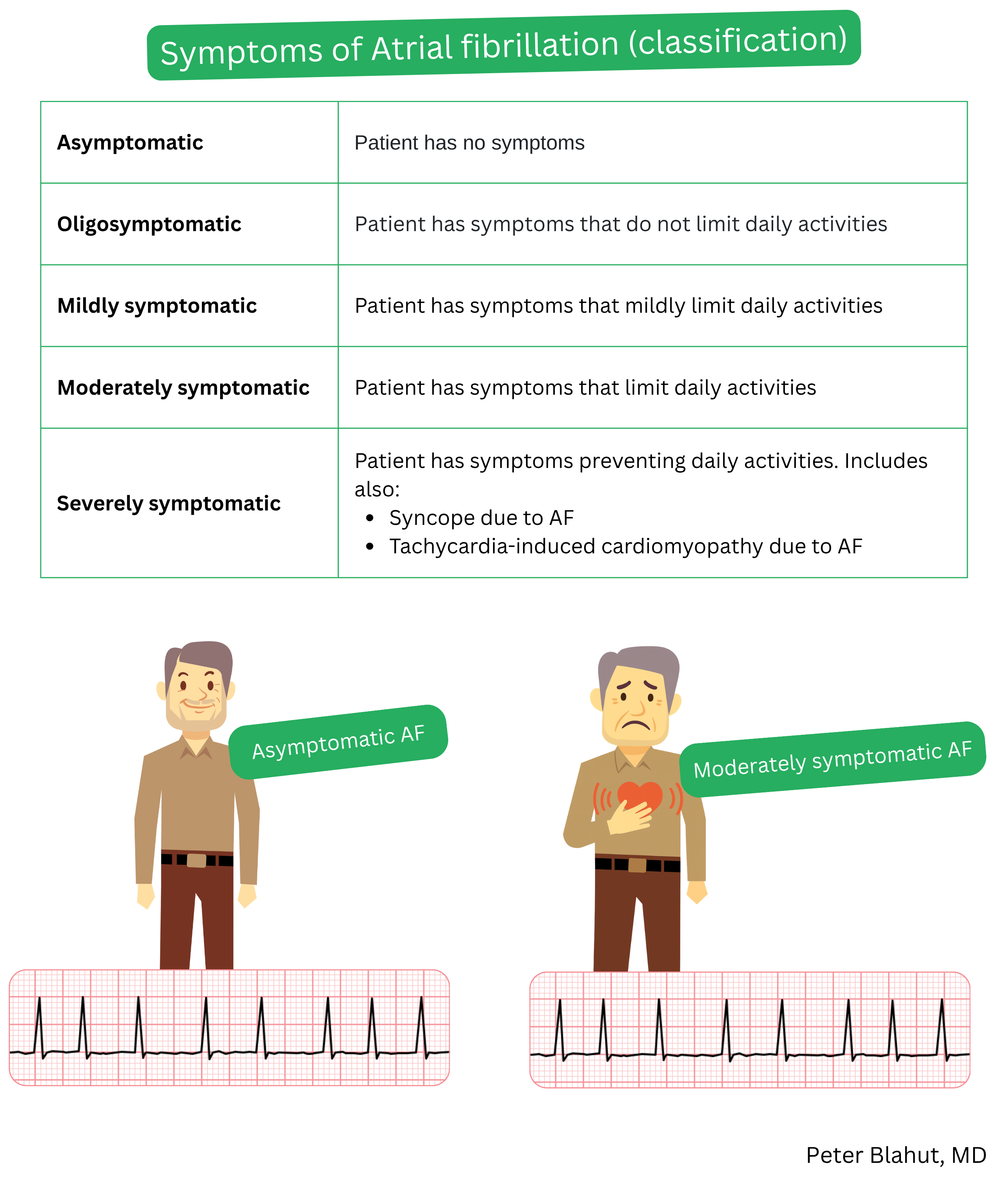 Table classifying atrial fibrillation symptom severity according to degree of symptomatic burden from asymptomatic to highly symptomatic forms with corresponding clinical consequences.