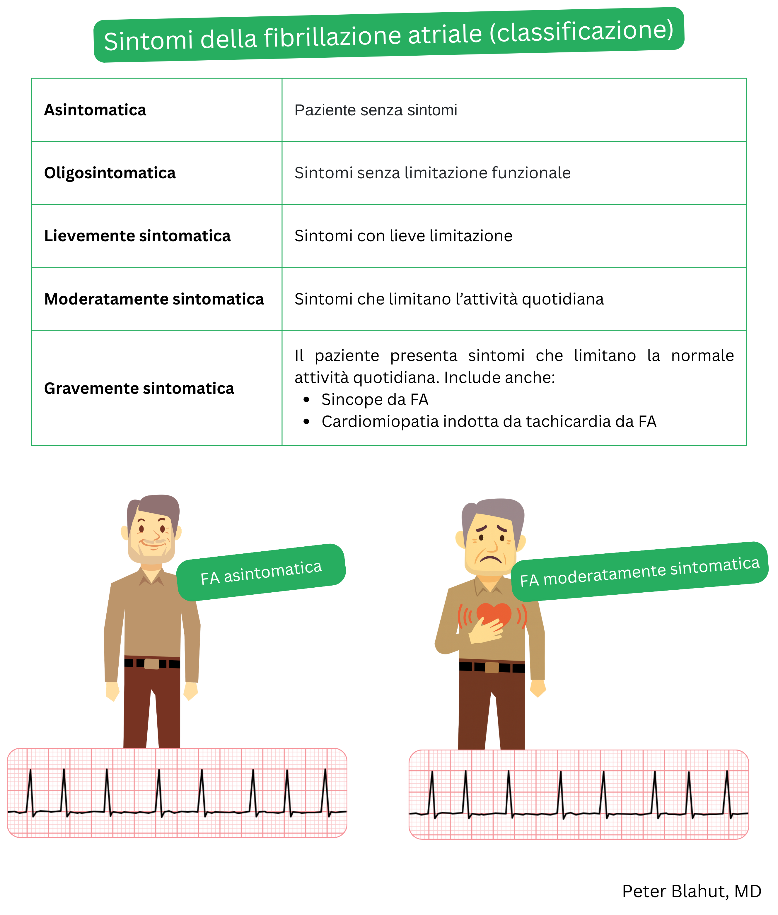 Tabella di classificazione della gravità dei sintomi della fibrillazione atriale in base al grado di carico sintomatologico, dalle forme asintomatiche a quelle gravemente sintomatiche, con indicazione delle conseguenze cliniche.