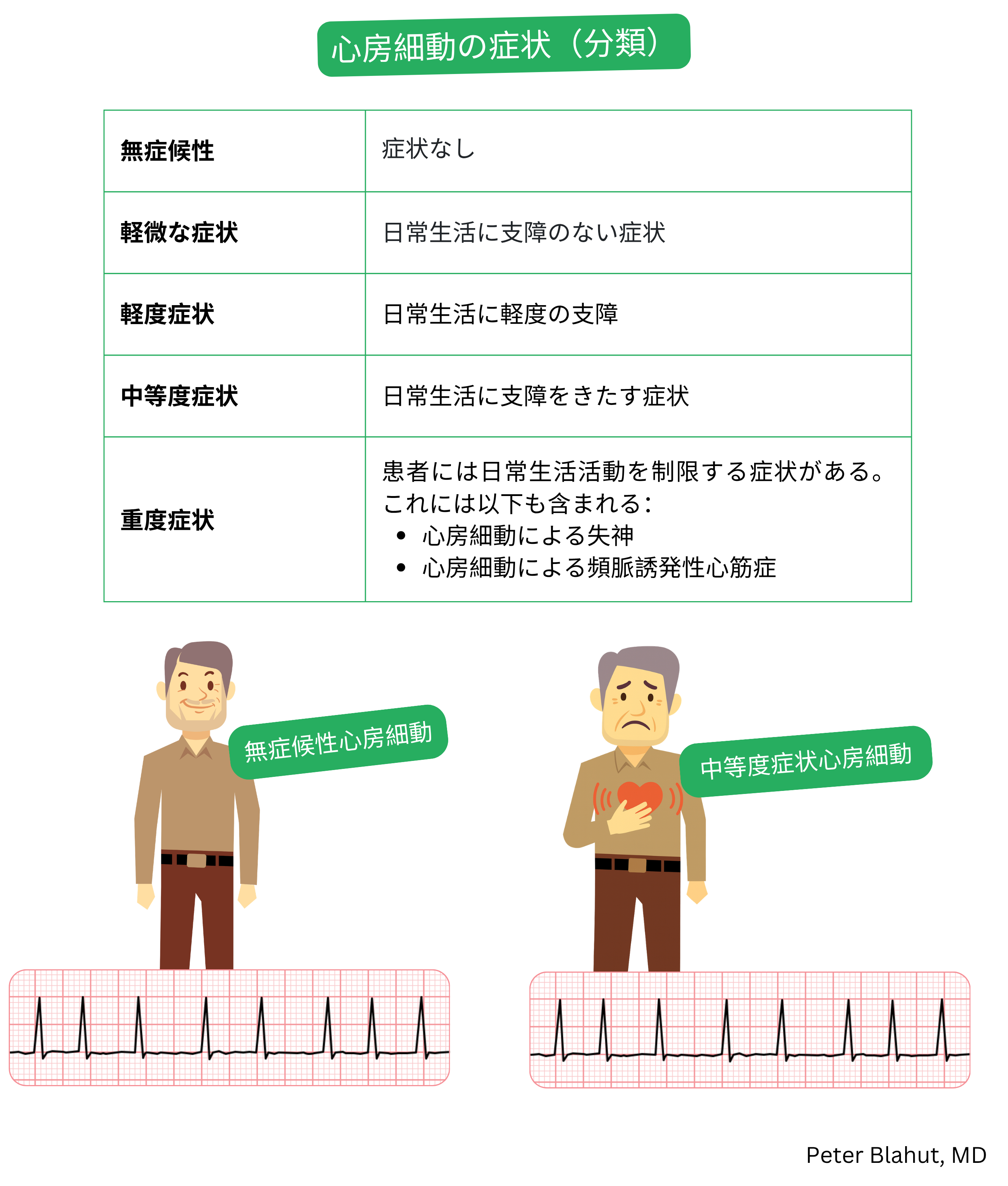 心房細動の症状重症度を無症候性から高度症候性までの症状負荷に基づき分類し、臨床的影響を示した表。