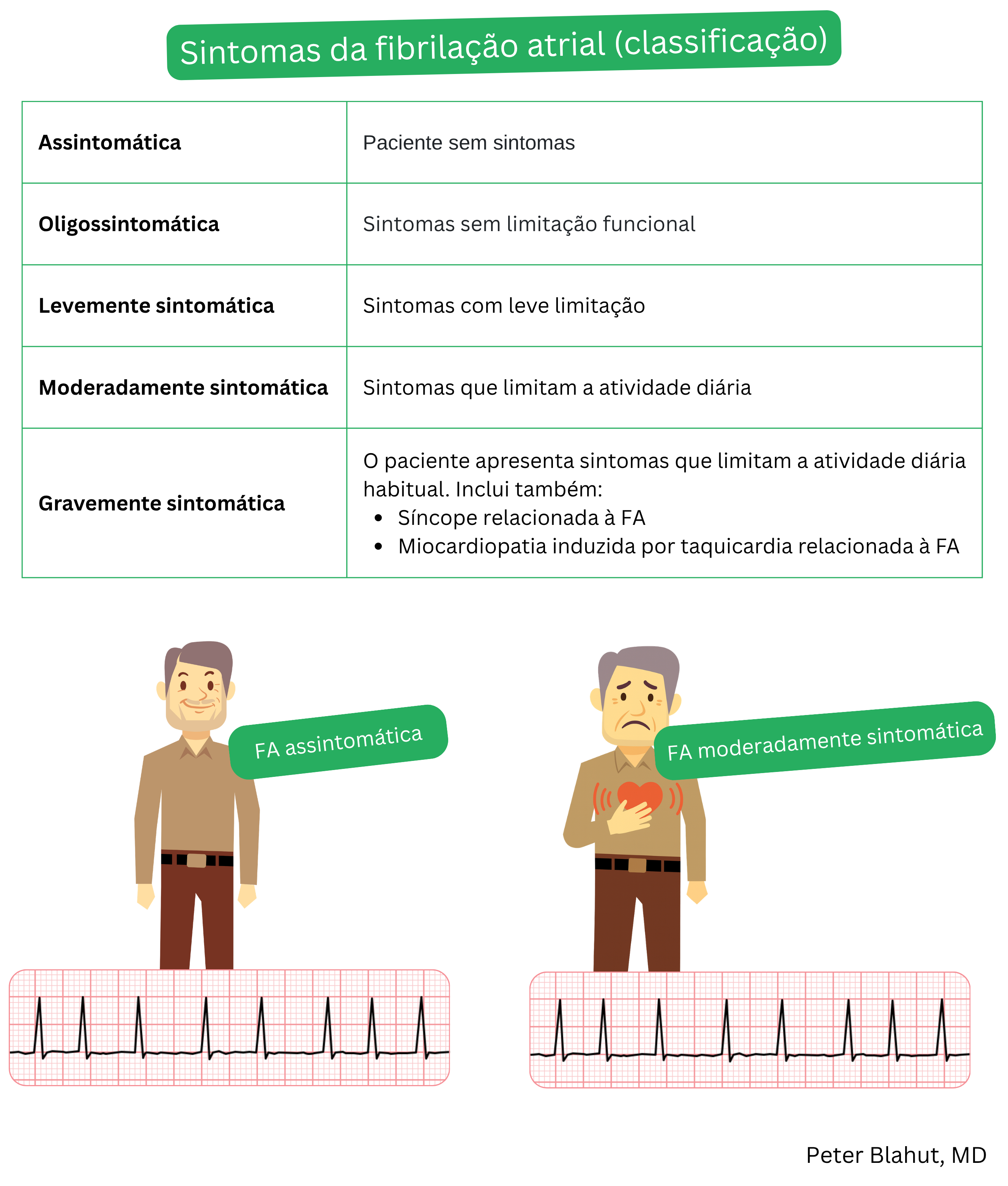 Tabela de classificação da gravidade dos sintomas da fibrilação atrial conforme o grau de carga sintomática, desde formas assintomáticas até altamente sintomáticas, com as respectivas consequências clínicas.