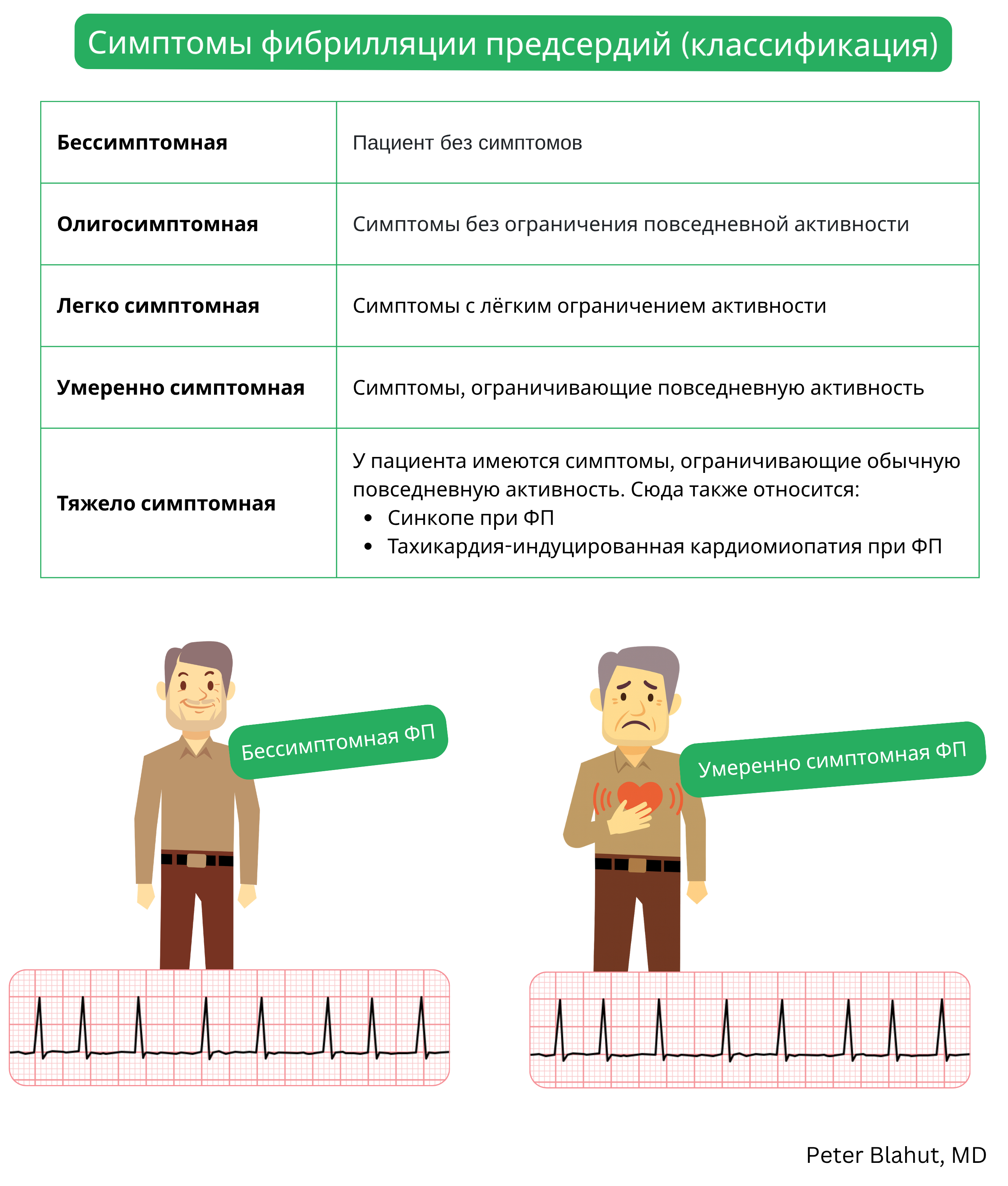 Таблица классификации тяжести симптомов фибрилляции предсердий по степени выраженности от бессимптомной до тяжело симптомной формы с указанием клинических последствий.
