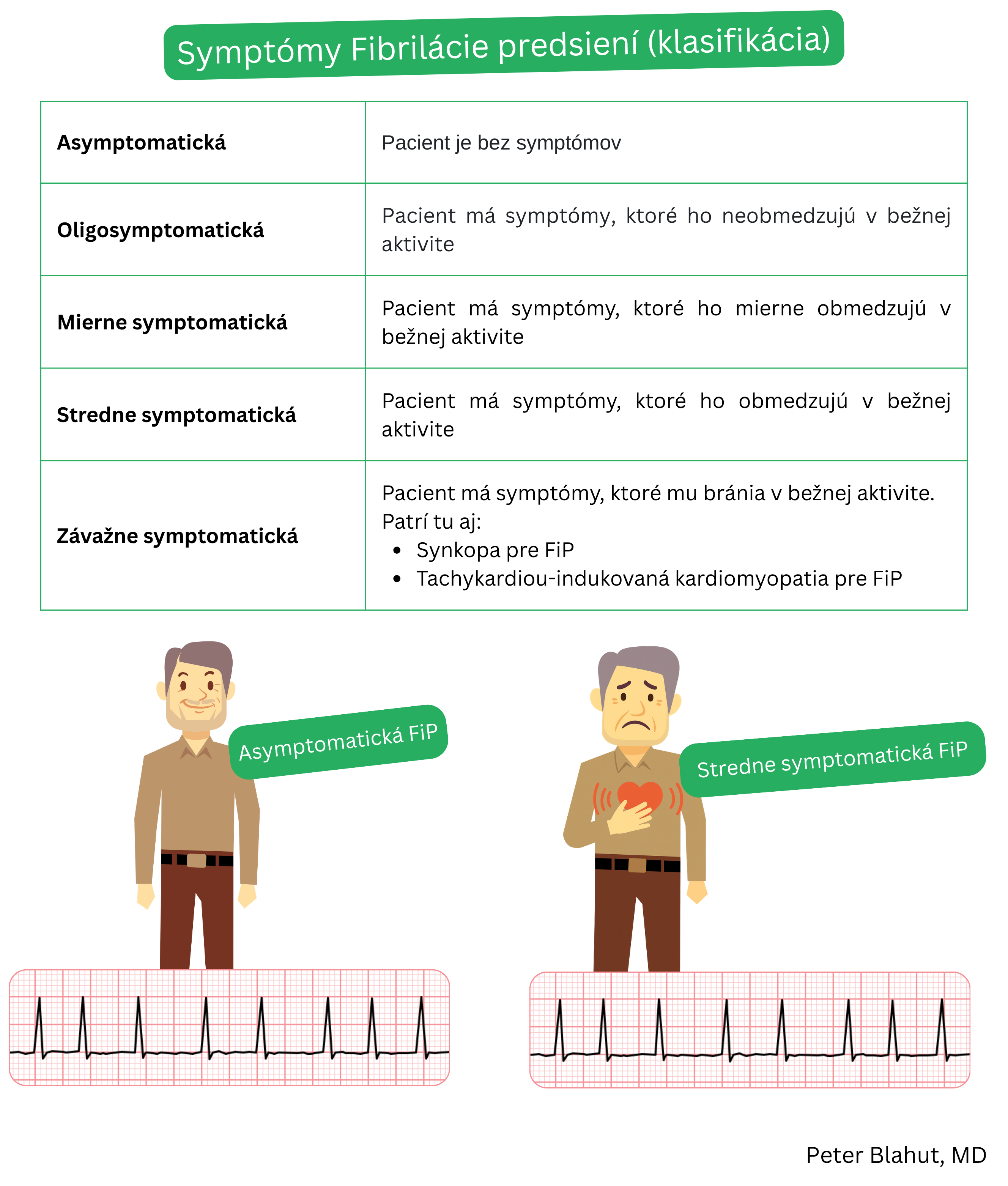 Tabuľka klasifikácie závažnosti symptómov fibrilácie predsiení podľa stupňa symptomatickosti od asymptomatickej po ťažko symptomatickú formu s uvedením klinických dôsledkov.