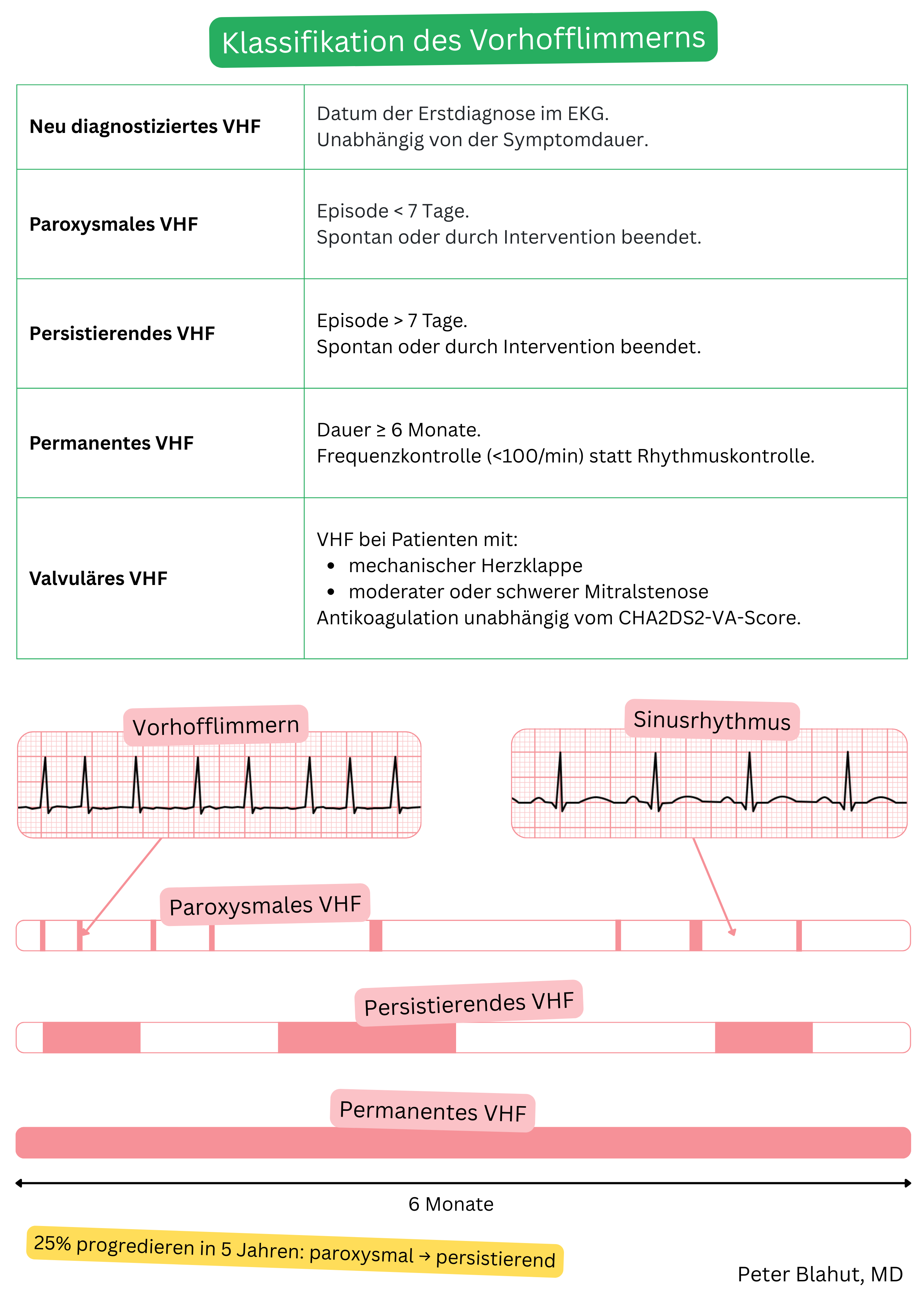 Tabelle zur Klassifikation des Vorhofflimmerns in neu diagnostizierte, paroxysmale, persistierende, permanente und valvuläre Form mit illustrativem Vergleich der EKG-Aufzeichnungen bei Vorhofflimmern und Sinusrhythmus.