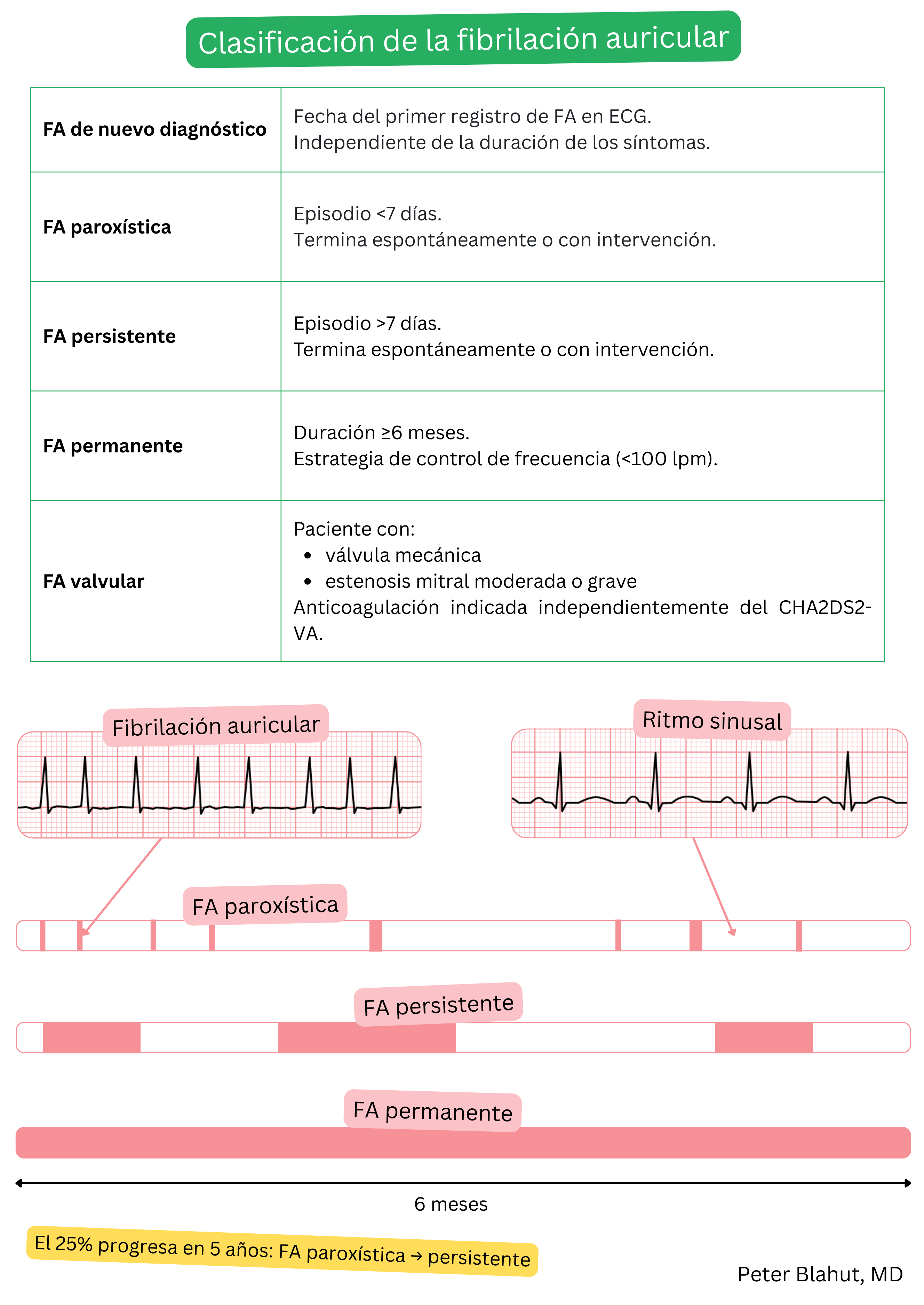 Tabla de clasificación de la fibrilación auricular en formas de nuevo diagnóstico, paroxística, persistente, permanente y valvular, con comparación ilustrativa de los trazados ECG en fibrilación auricular y ritmo sinusal.