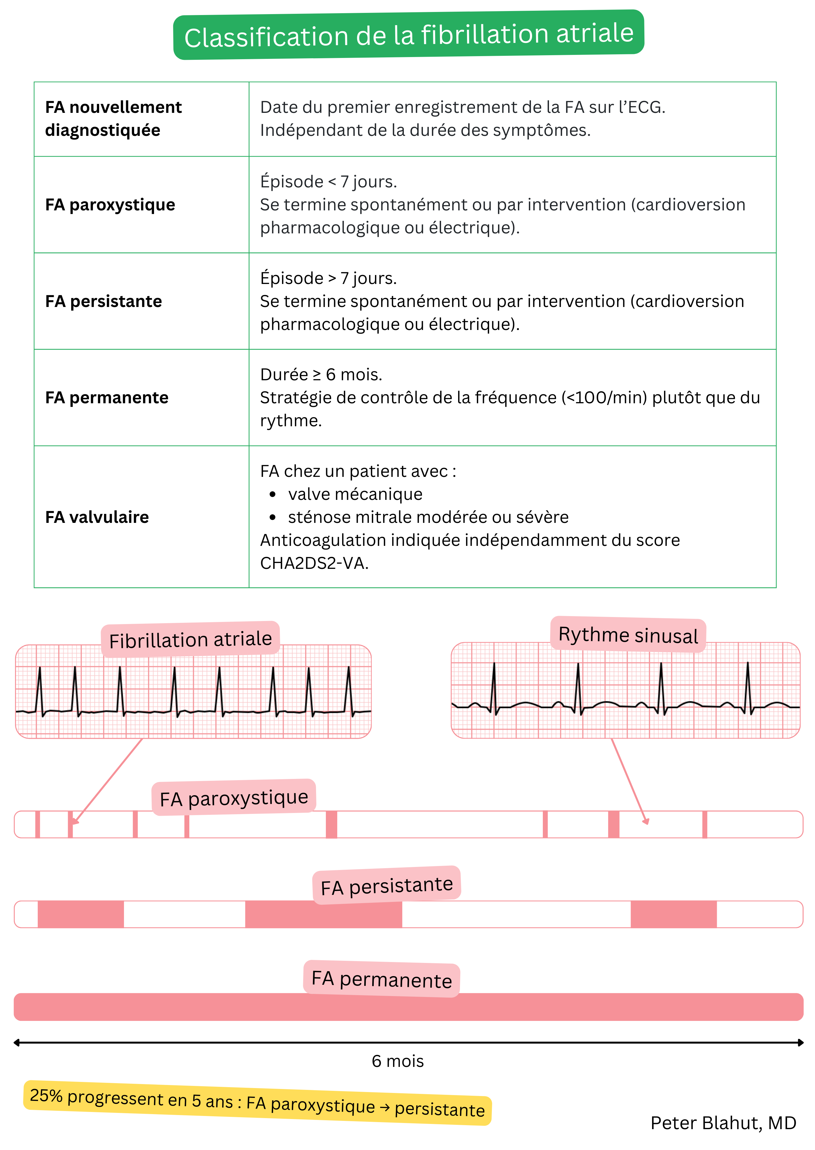 Tableau de classification de la fibrillation auriculaire en formes nouvellement diagnostiquée, paroxystique, persistante, permanente et valvulaire, avec comparaison illustrative des tracés ECG en fibrillation auriculaire et en rythme sinusal.
