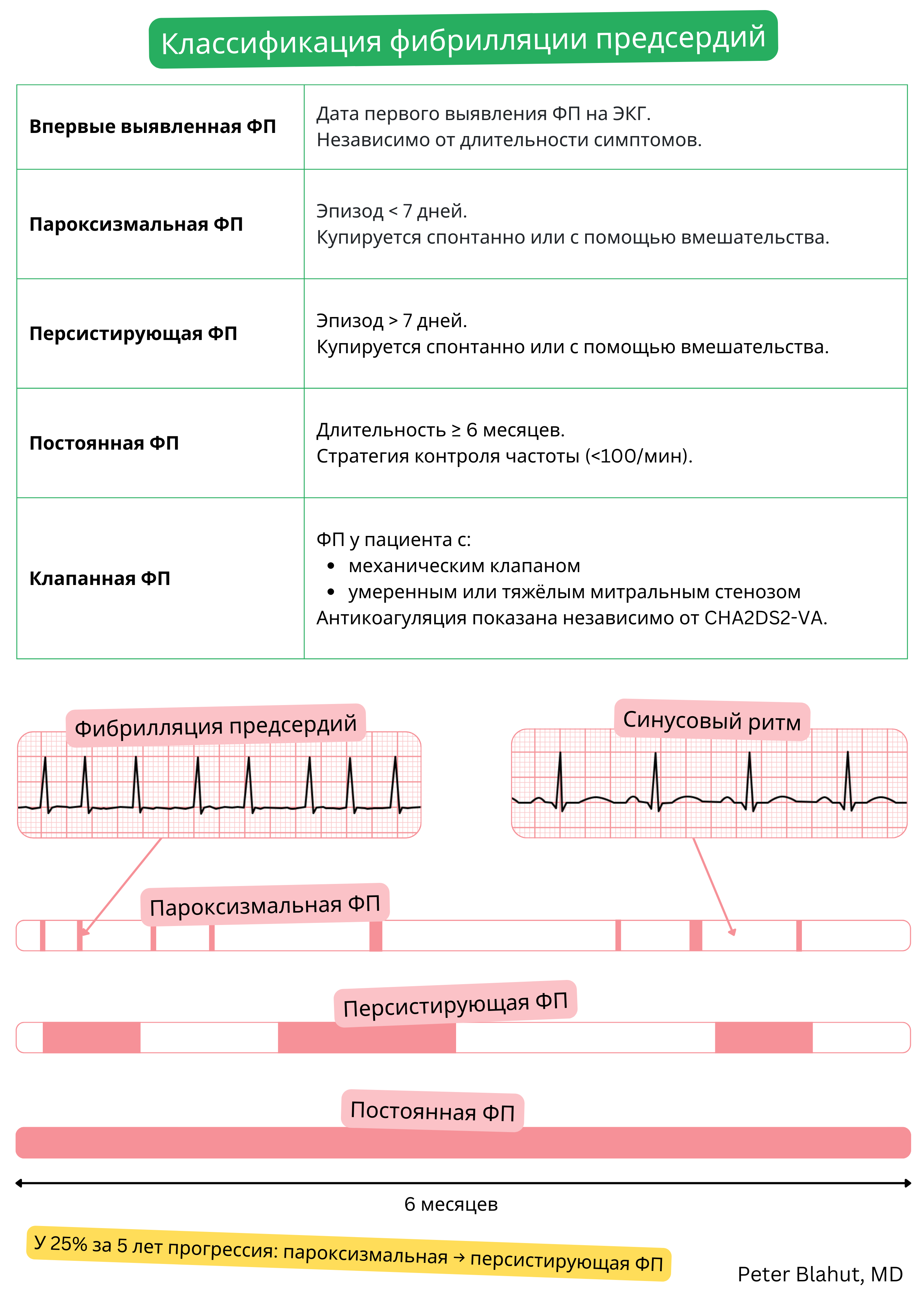 Таблица классификации фибрилляции предсердий на впервые выявленную, пароксизмальную, персистирующую, постоянную и клапанную формы с иллюстративным сравнением ЭКГ при фибрилляции предсердий и синусовом ритме.
