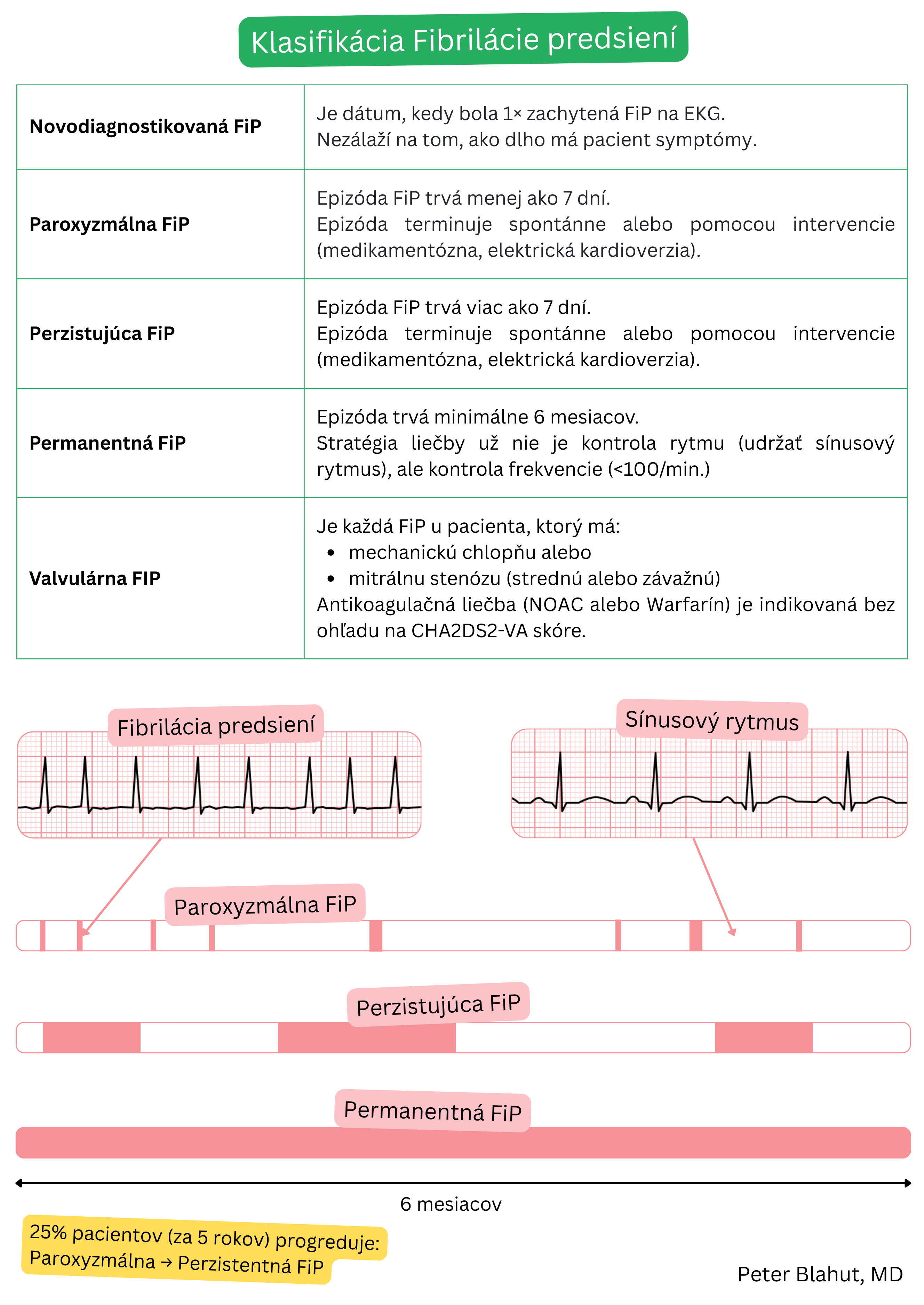 Tabuľka klasifikácie fibrilácie predsiení na novodiagnostikovanú, paroxyzmálnu, perzistentnú, permanentnú a valvulárnu formu s ilustračným porovnaním EKG záznamu fibrilácie predsiení a sínusového rytmu.