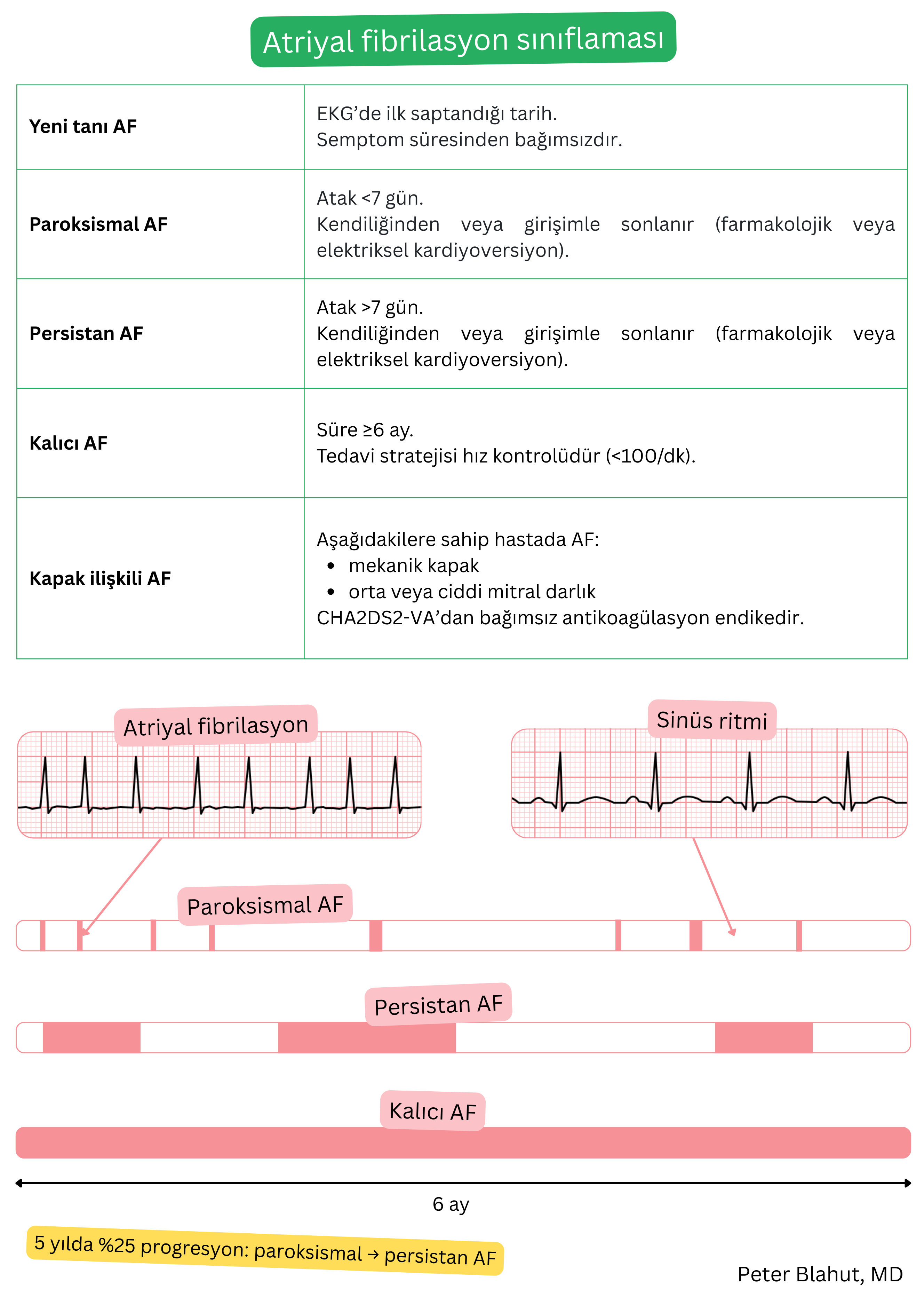 Atriyal fibrilasyonun yeni tanı konmuş, paroksismal, persistan, permanent ve valvüler formlara göre sınıflandırmasını gösteren tablo ve atriyal fibrilasyon ile sinüs ritminin EKG kayıtlarının karşılaştırmalı gösterimi.