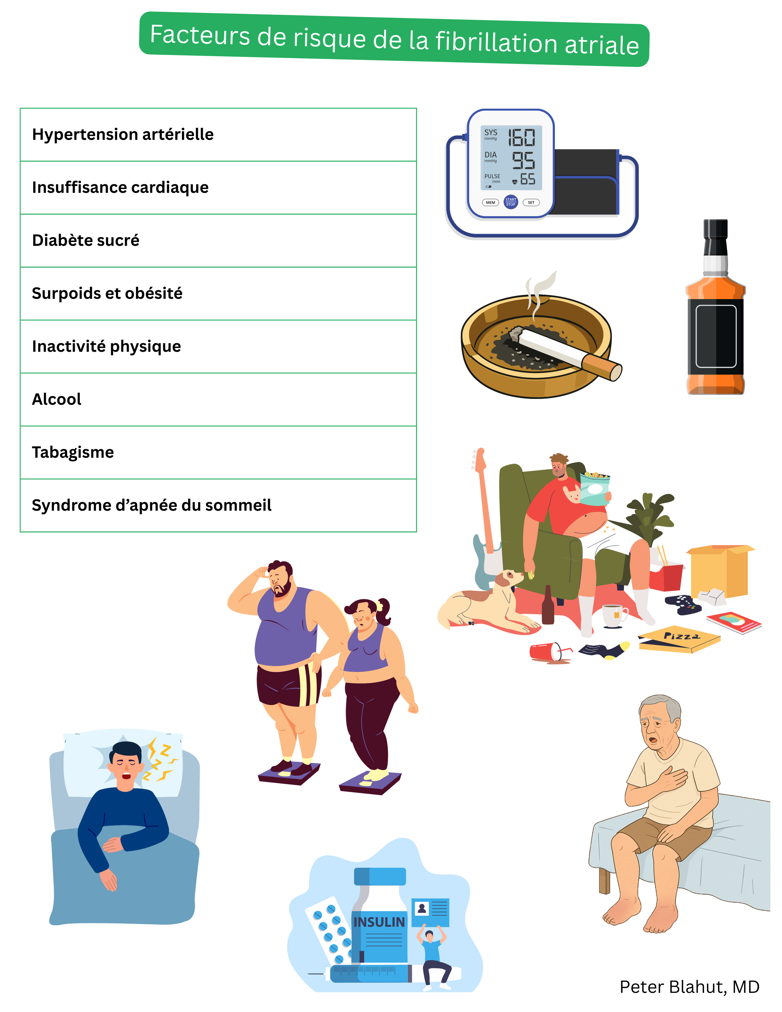 Aperçu des principaux facteurs de risque de la fibrillation auriculaire, notamment l’hypertension artérielle, l’insuffisance cardiaque, le diabète sucré, l’obésité, la sédentarité, la consommation excessive d’alcool, le tabagisme et le syndrome d’apnée obstructive du sommeil.