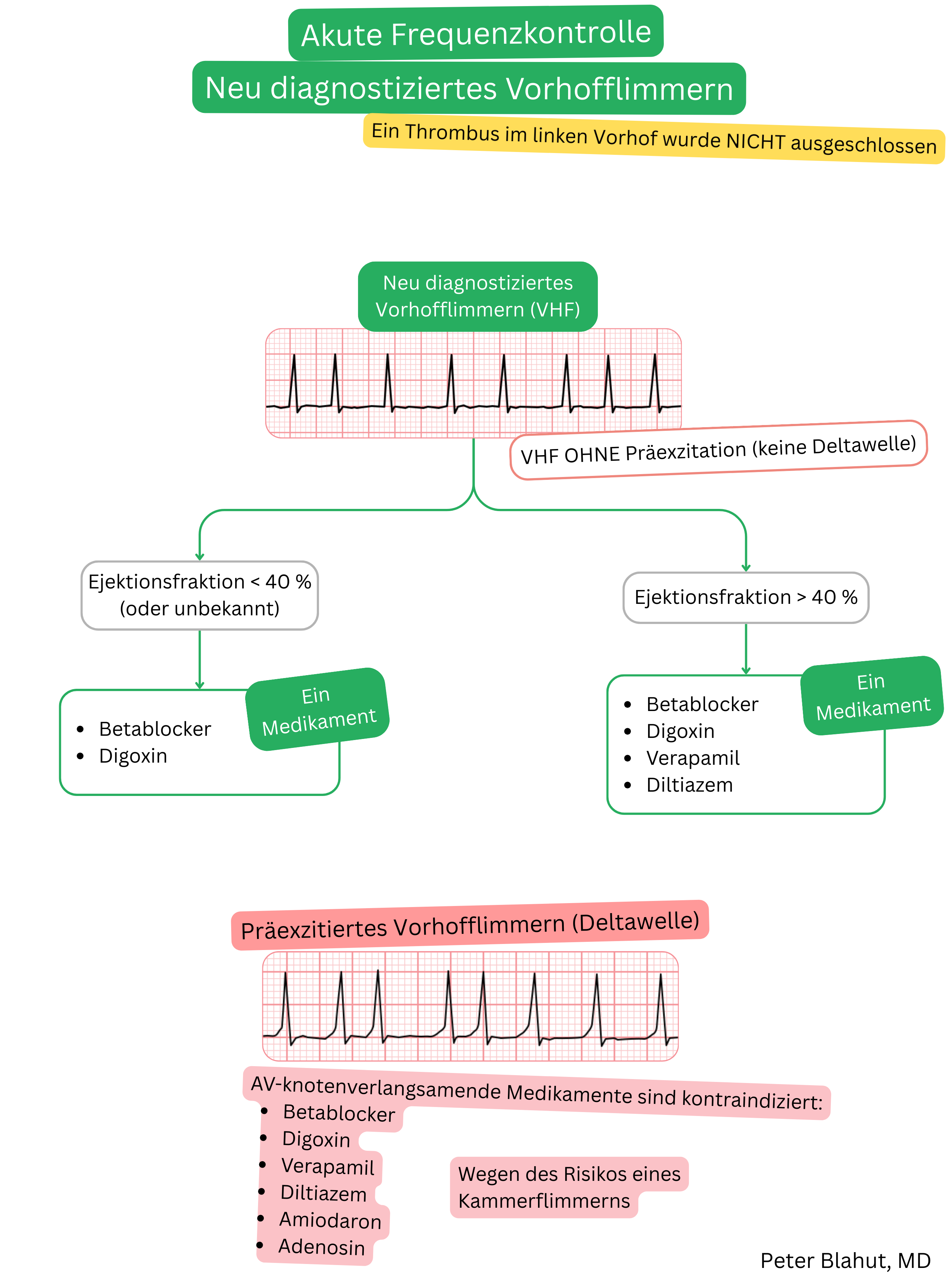 Algorithmus zur akuten Frequenzkontrolle bei neu diagnostiziertem Vorhofflimmern ohne Präexzitation abhängig von der linksventrikulären Ejektionsfraktion mit Hinweis auf die Kontraindikation von AV-knotenspezifischen Medikamenten bei präexzitiertem Vorhofflimmern.
