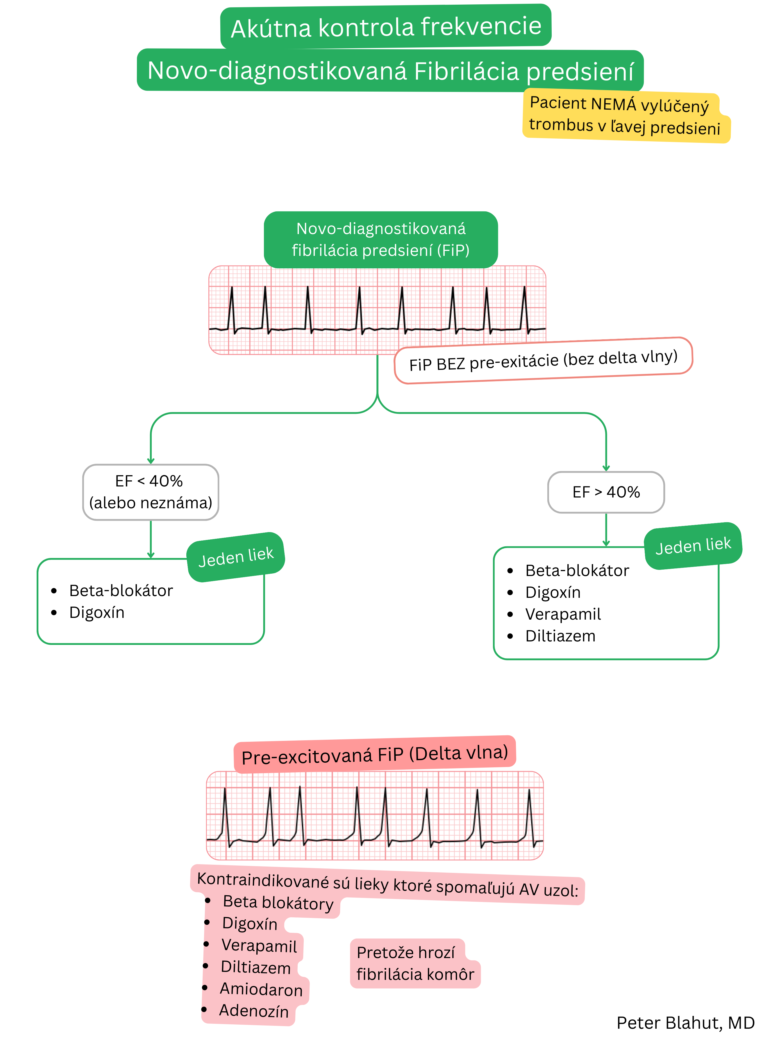 Algoritmus akútnej kontroly frekvencie pri novodiagnostikovanej fibrilácii predsiení bez preexcitácie podľa ejekčnej frakcie ľavej komory s upozornením na kontraindikáciu AV-nodálnych liekov pri preexcitovanej fibrilácii predsiení.