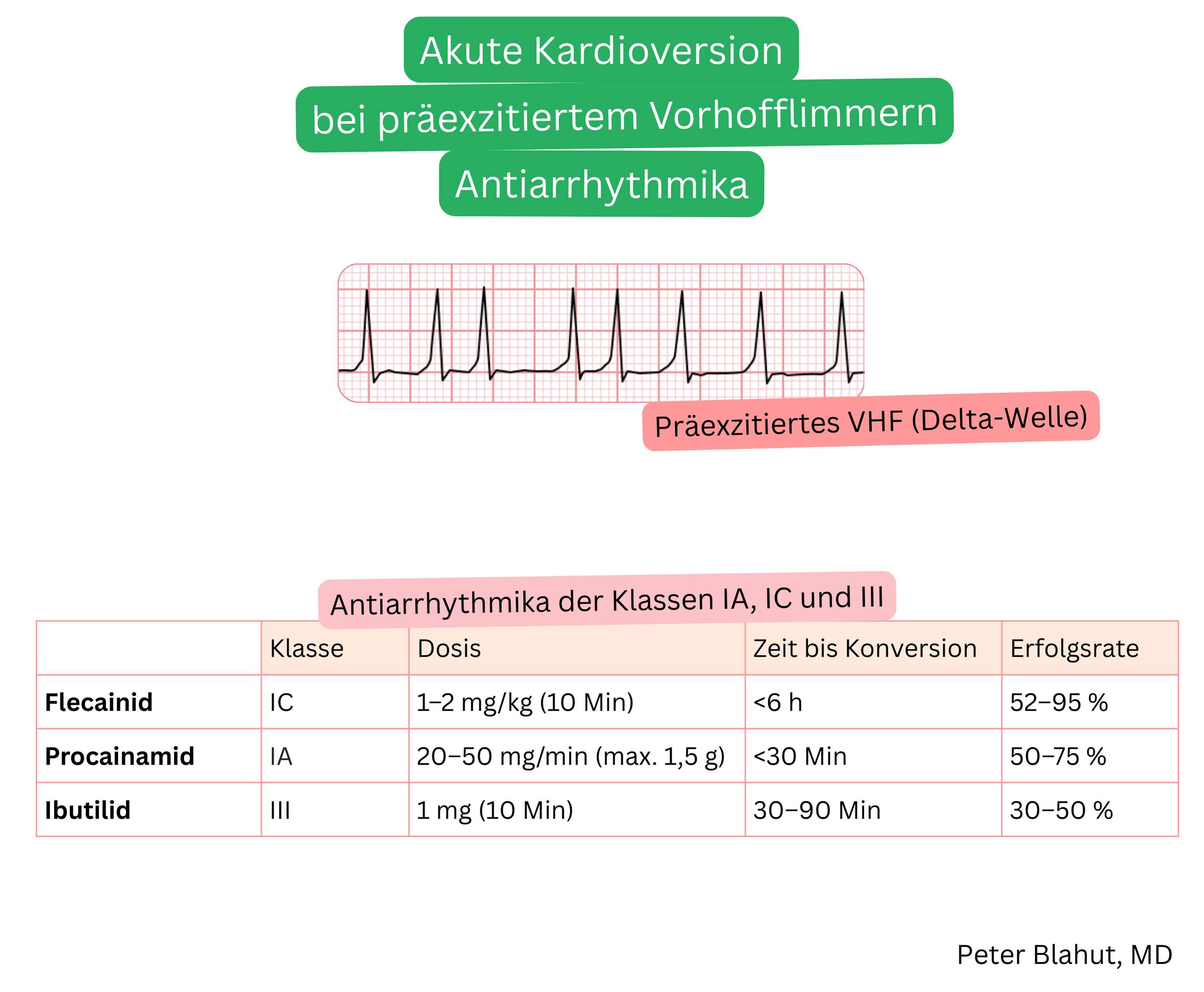 Überblick über Antiarrhythmika der Klassen IA, IC und III zur akuten Kardioversion bei präexzitiertem Vorhofflimmern mit Dosierung, Zeit bis zur Konversion und Behandlungserfolg.