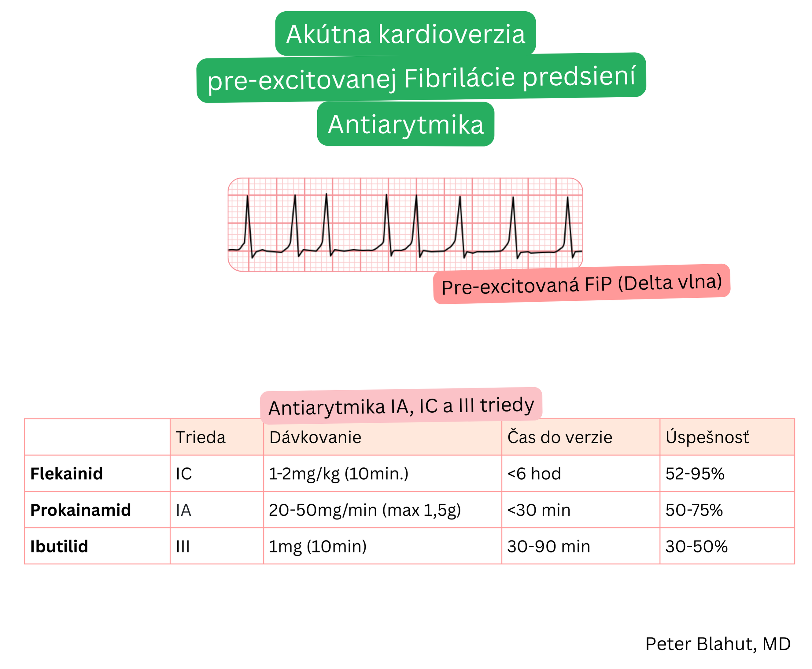 Prehľad antiarytmík triedy IA, IC a III na akútnu kardioverziu preexcitovanej fibrilácie predsiení s dávkovaním, časom do konverzie a úspešnosťou liečby.