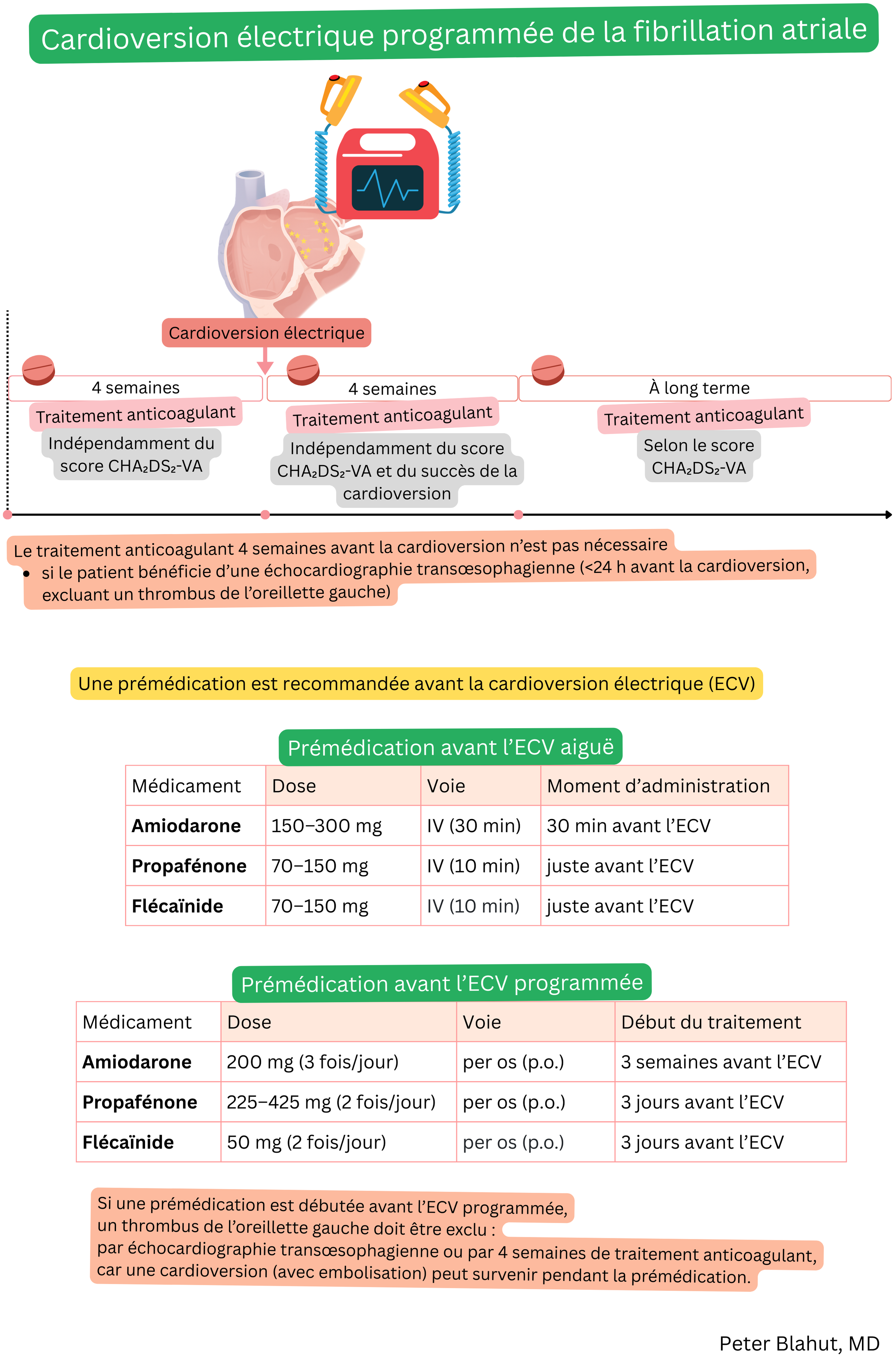 Schéma de cardioversion électrique programmée dans la fibrillation auriculaire avec anticoagulation recommandée avant et après la procédure et prémédication antiarythmique.