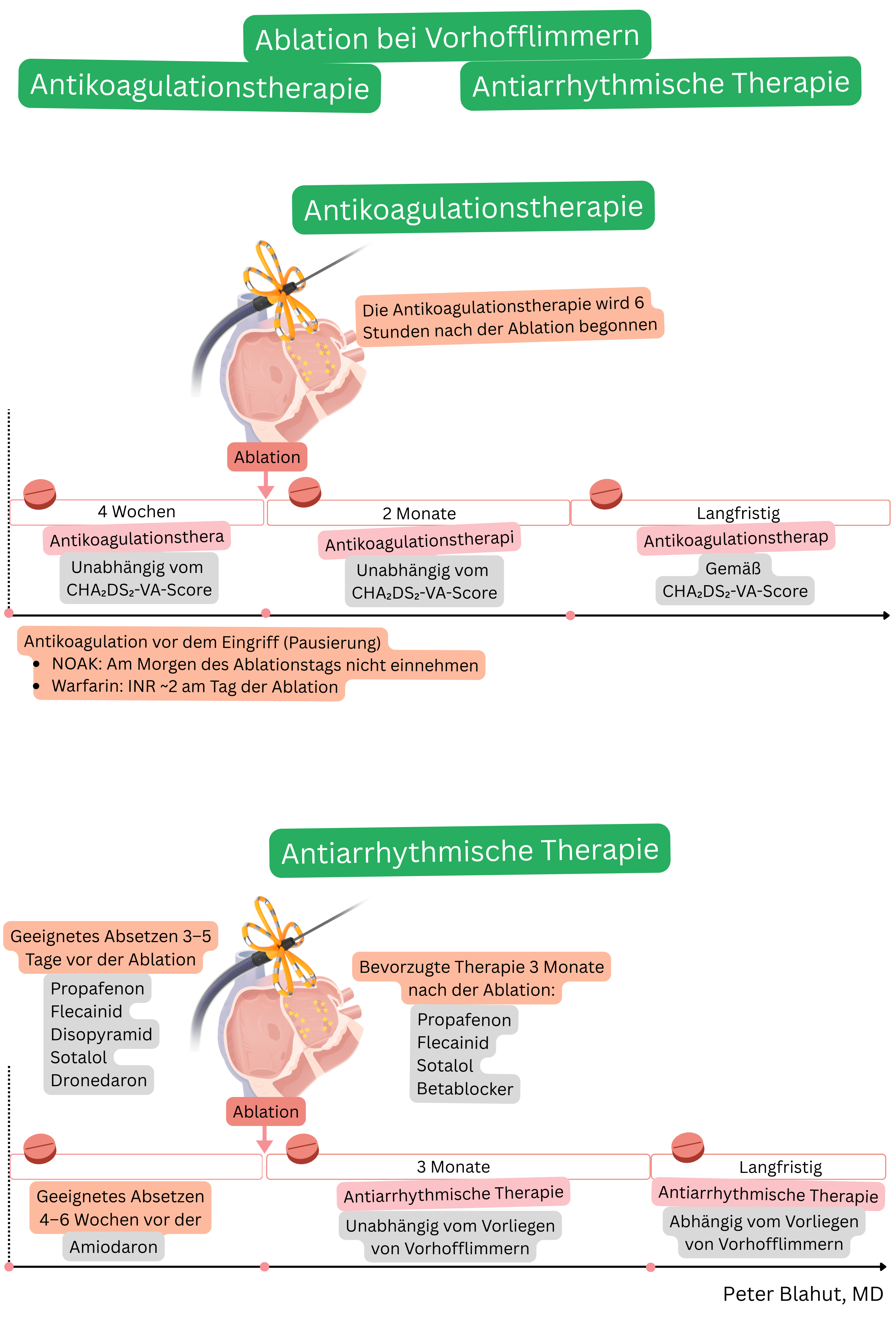 Schema der Antikoagulations- und Antiarrhythmikatherapie vor und nach Katheterablation bei Vorhofflimmern einschließlich Zeitpunkt von Unterbrechung und Fortführung gemäß CHA2DS2-VA-Score und Vorliegen einer Arrhythmie.