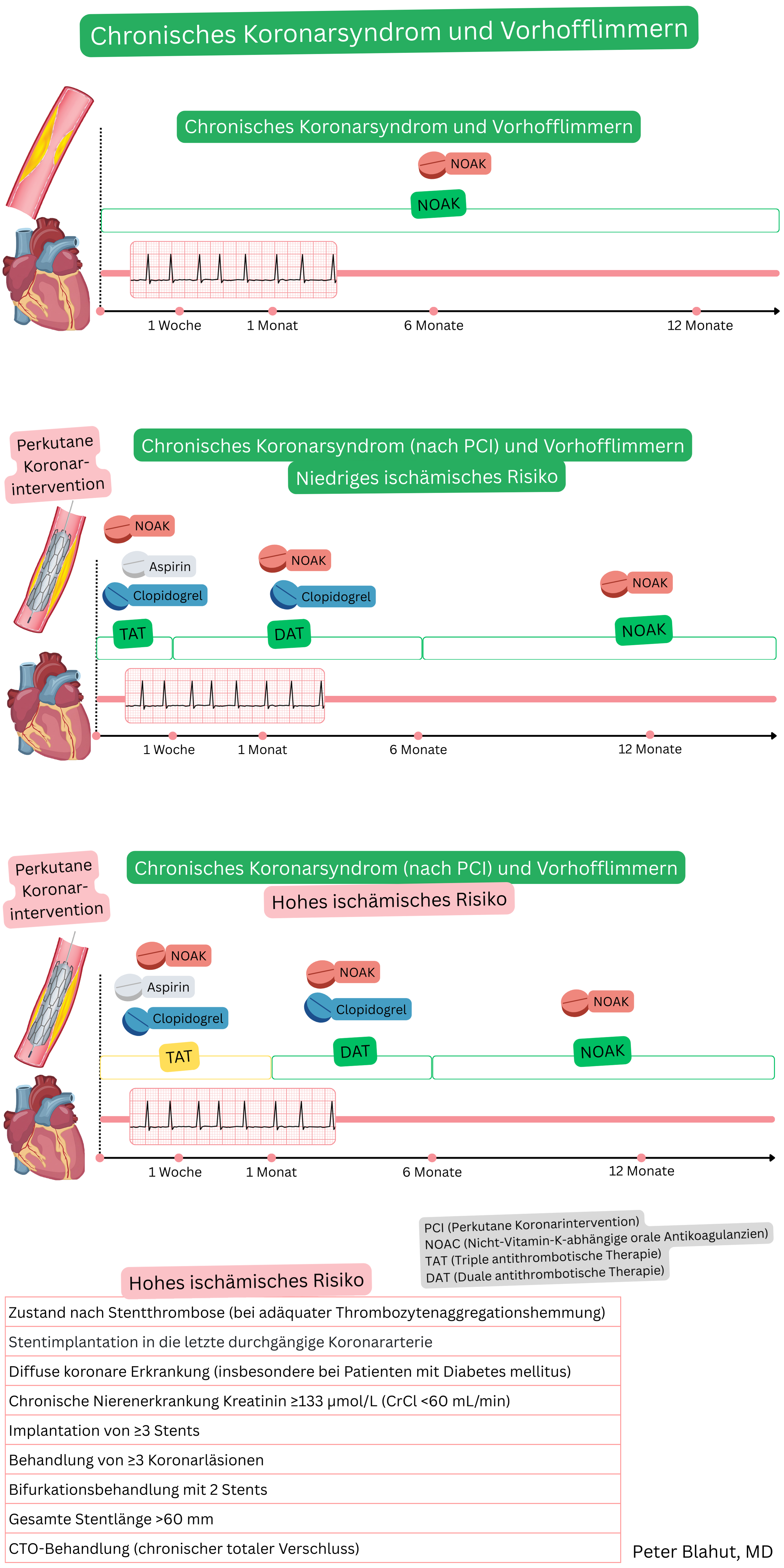 Schema der antithrombotischen Therapie bei Patienten mit chronischem Koronarsyndrom und Vorhofflimmern, einschließlich NOAK-Monotherapie sowie Post-PCI-Strategie mit TAT, DAT und anschließender NOAK-Monotherapie entsprechend dem ischämischen Risiko über 12 Monate.